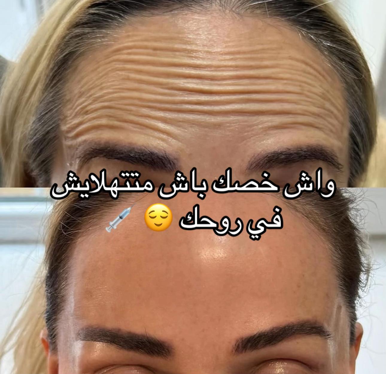 @Monica vega