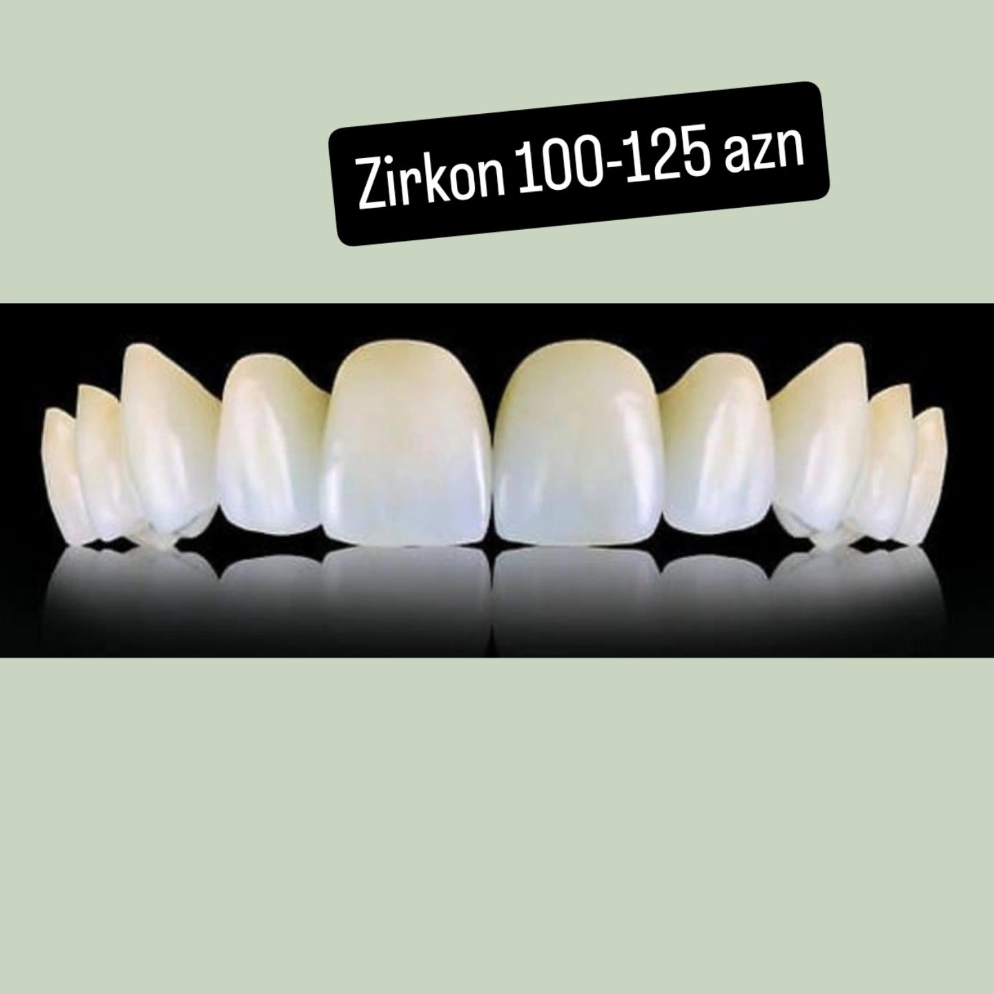 @implant.32