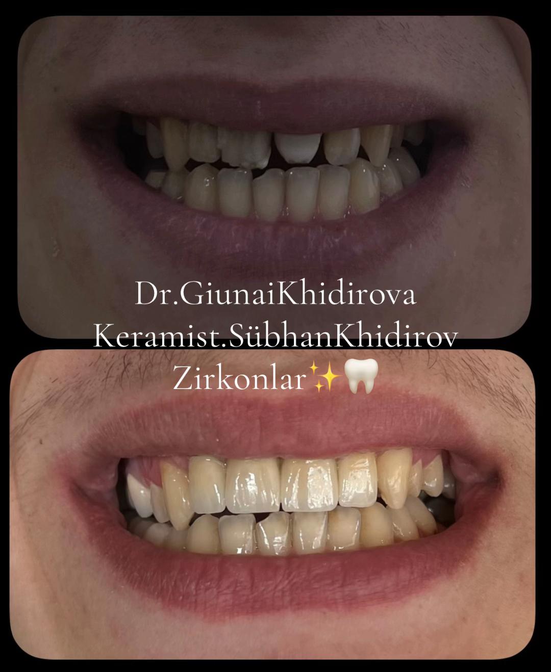 @Dr.Гюнай