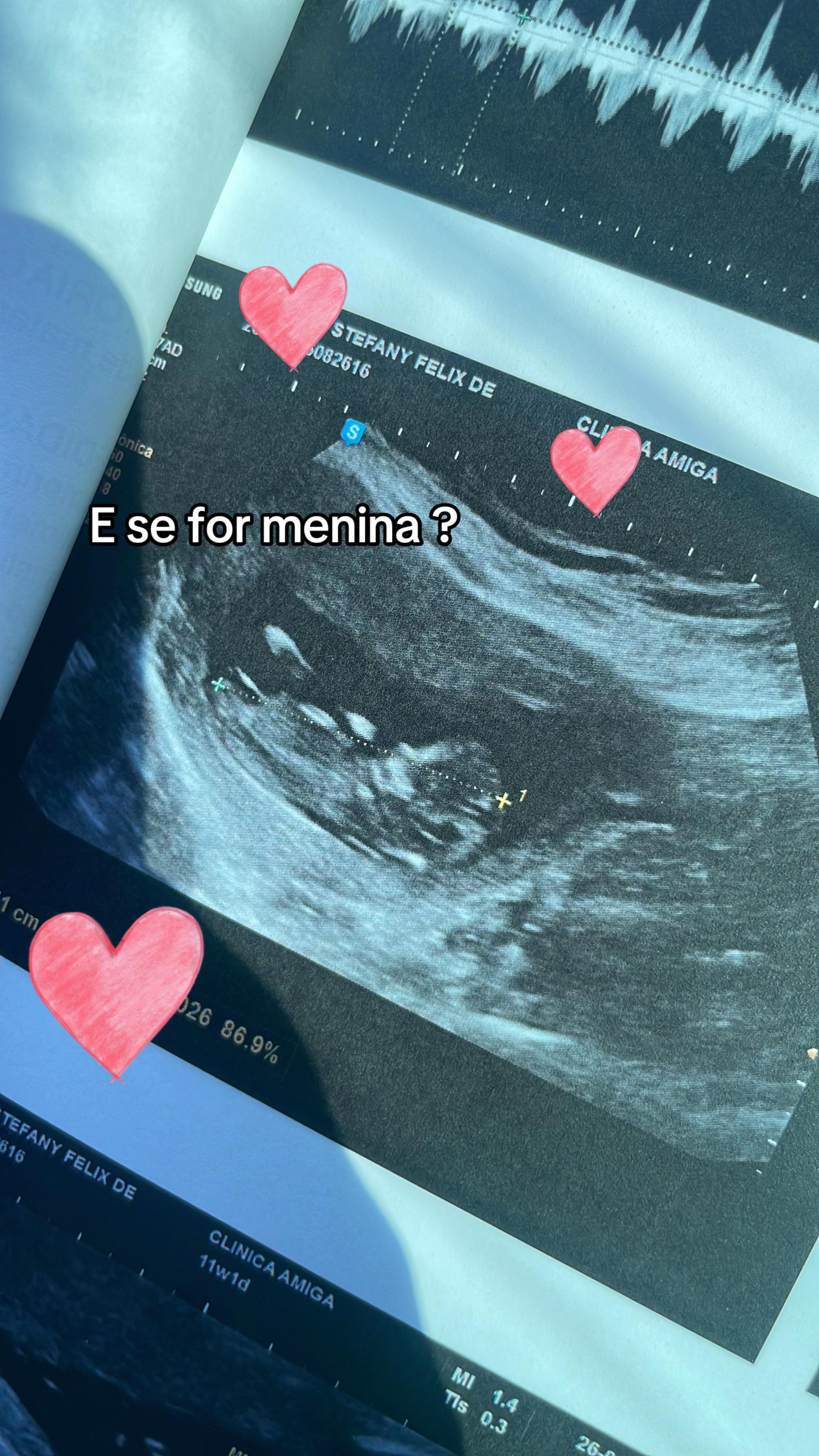 @Stefany Felix
