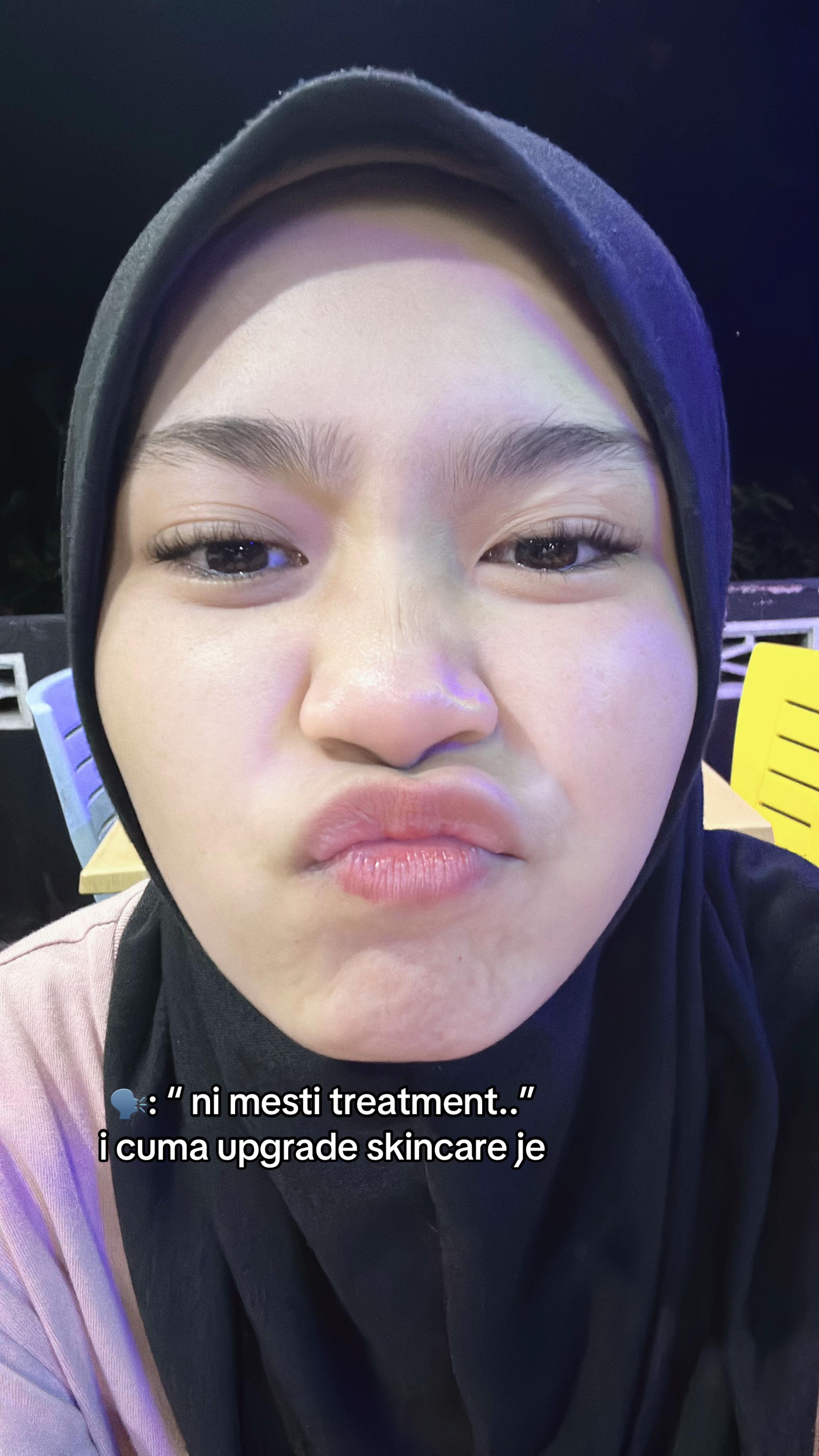 @iraa