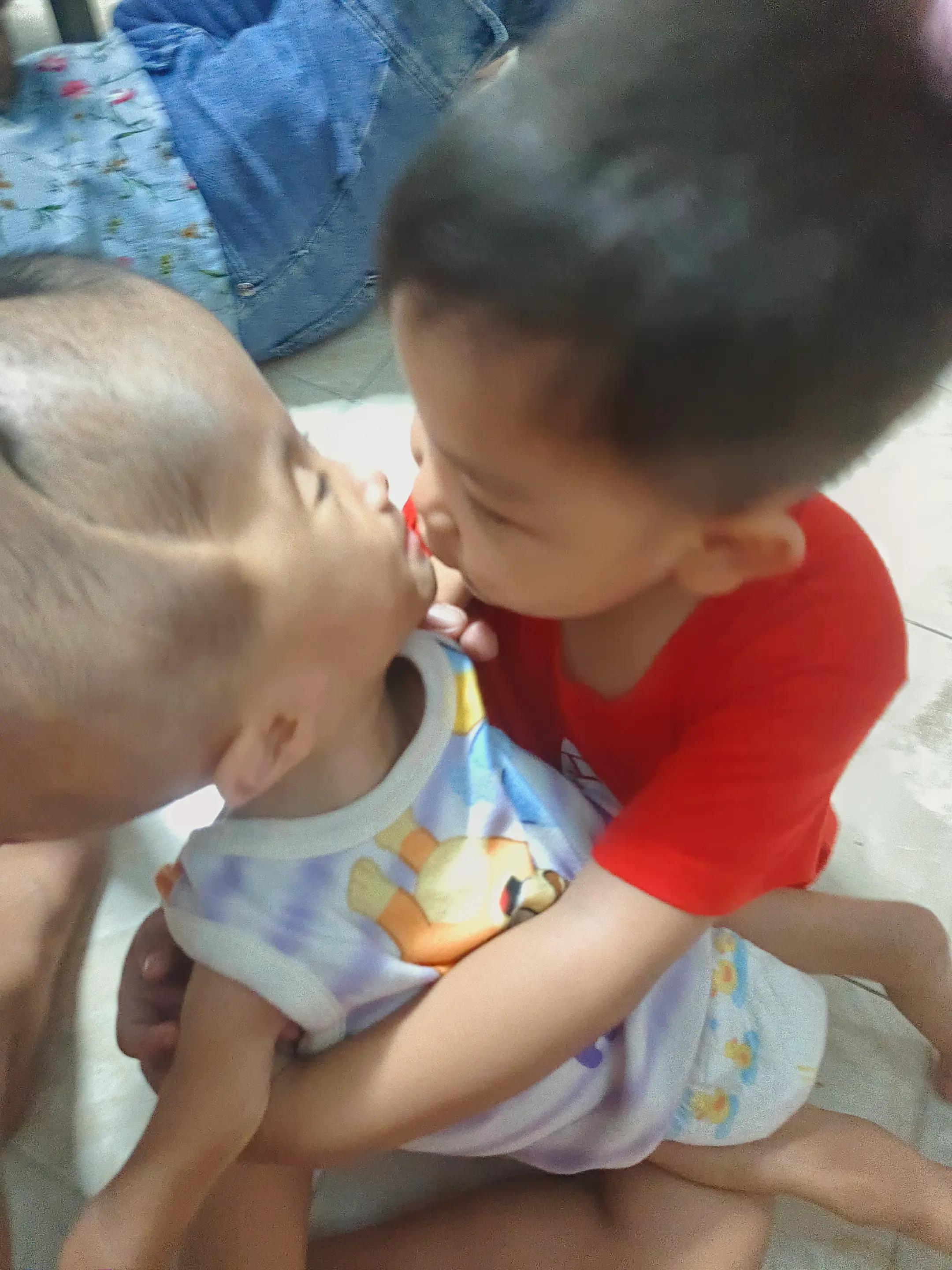 @บู้บี้เด็กหัวโตมีน้ำในโพรงสมอง
