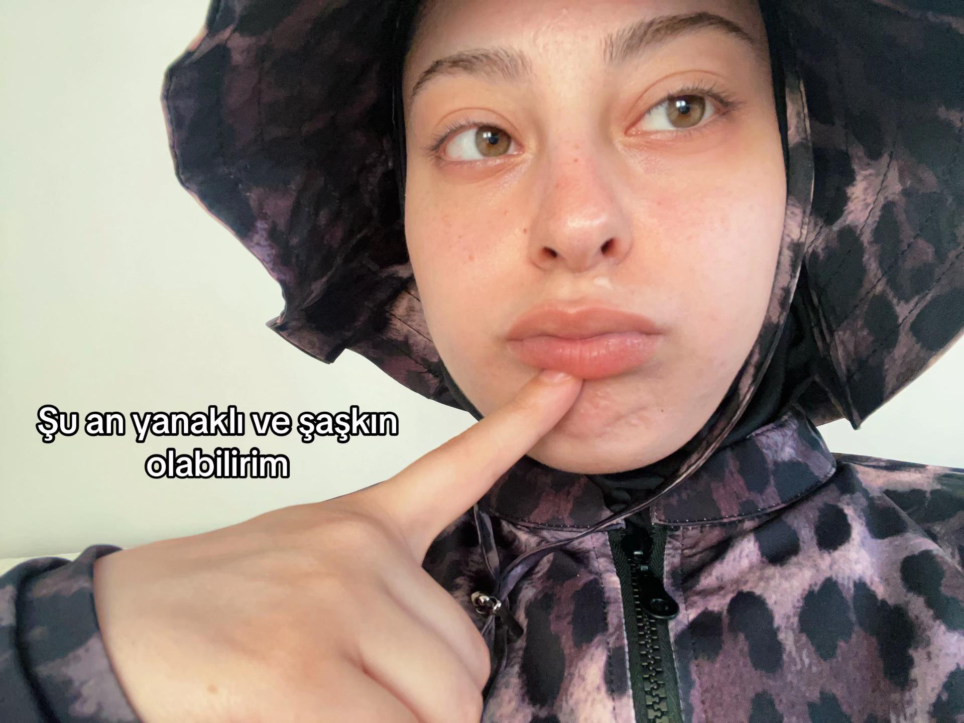 @Kpraw