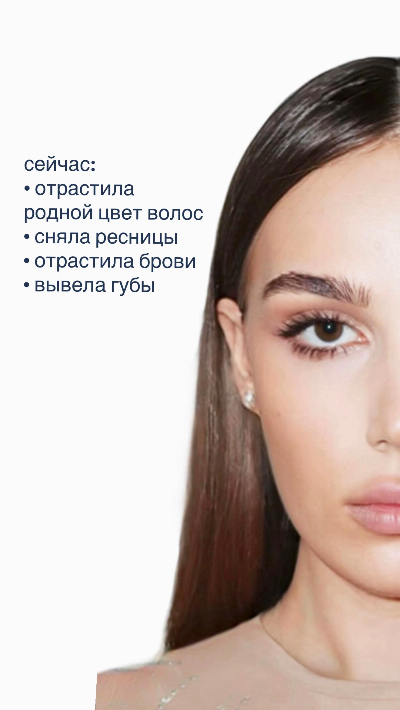 @Alina