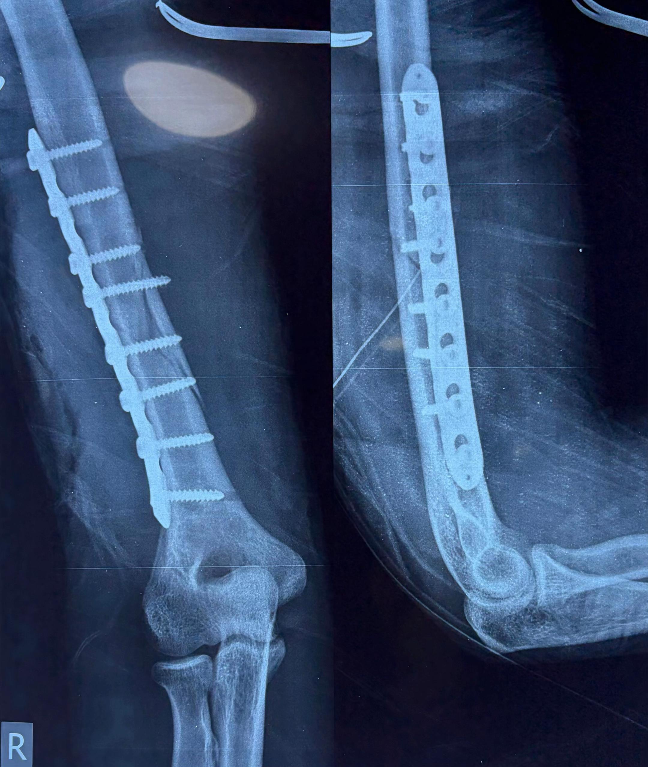 @Orthopedic_Surgeon_Arbind