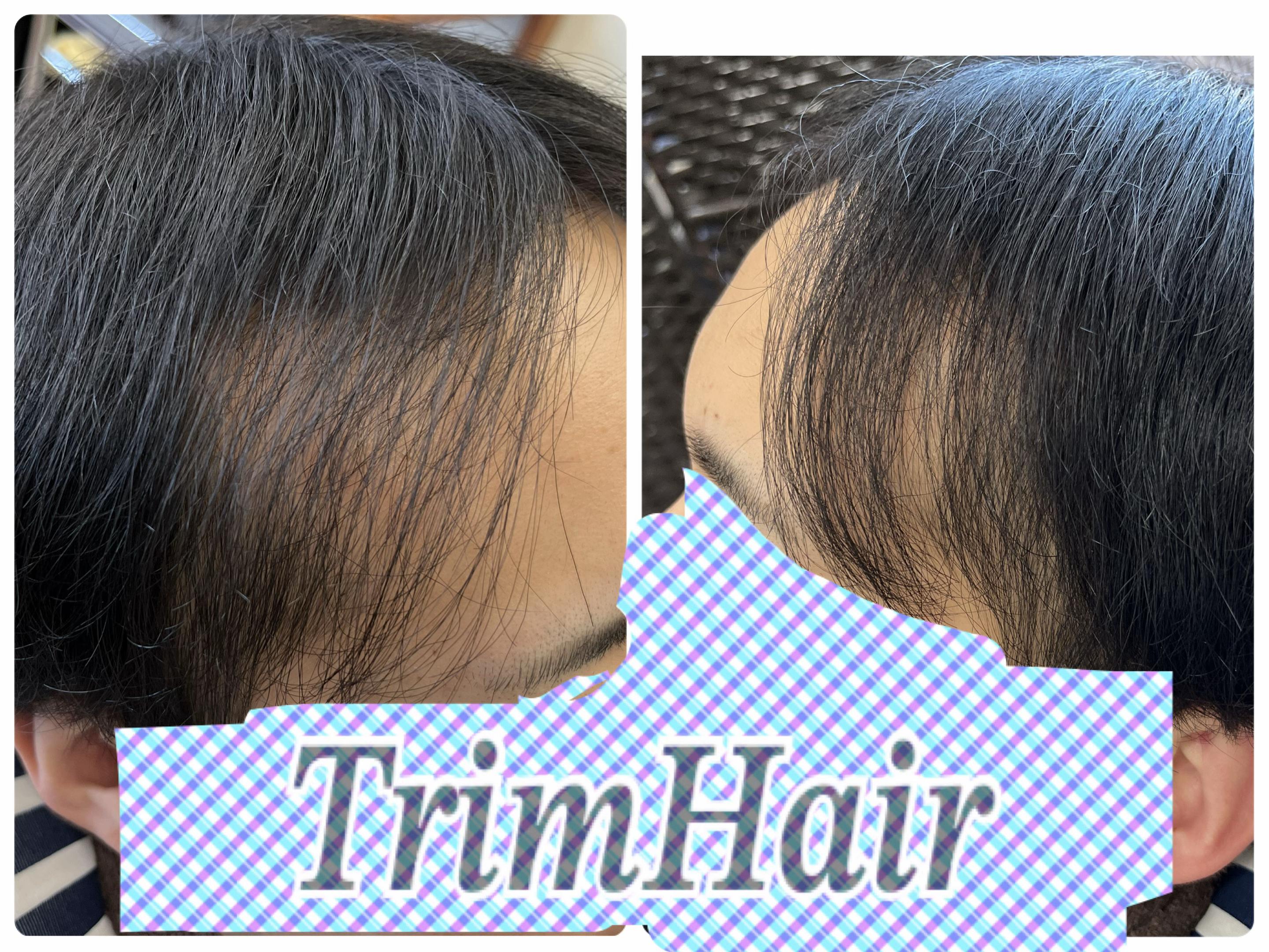 @Trim Hair