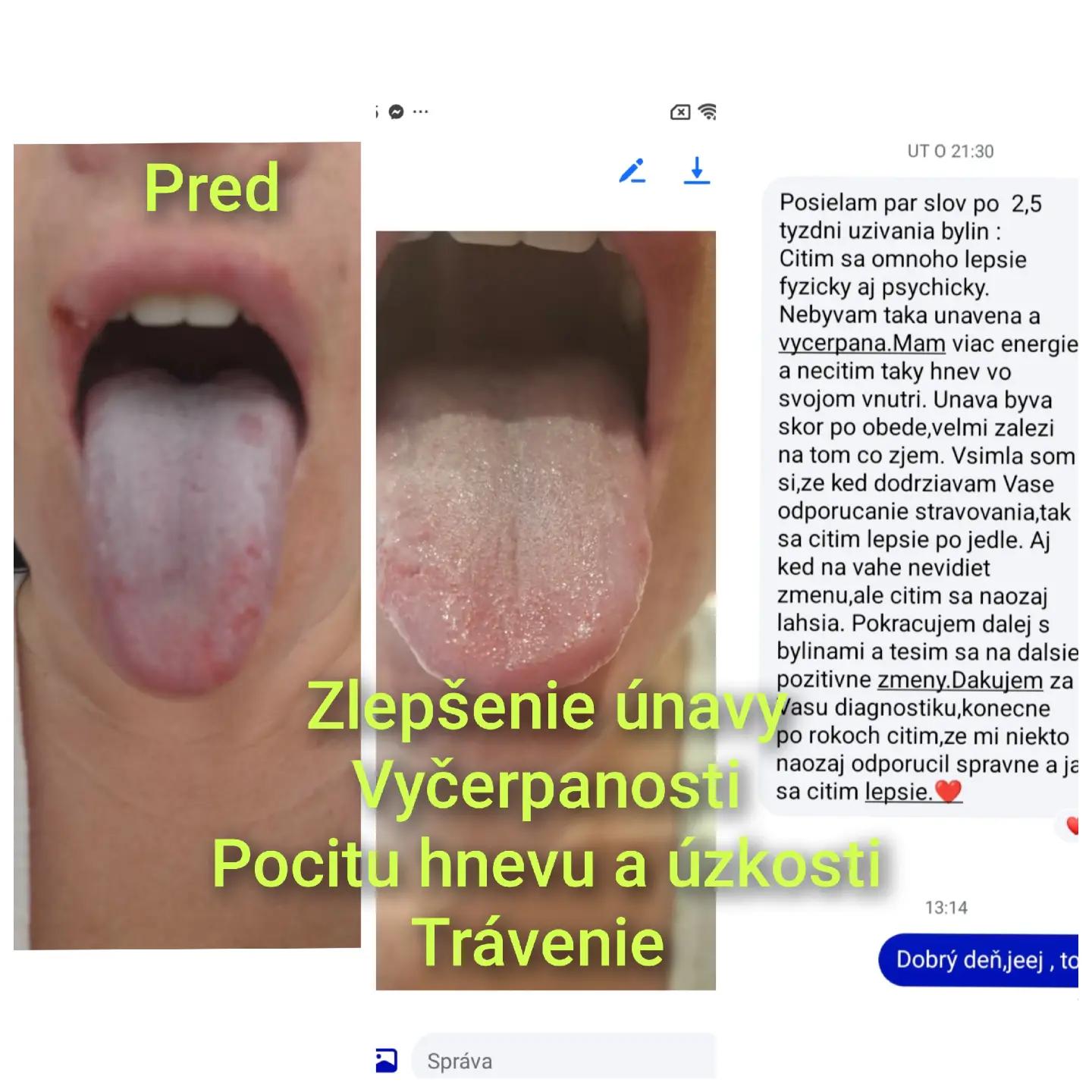 @samoliečenie