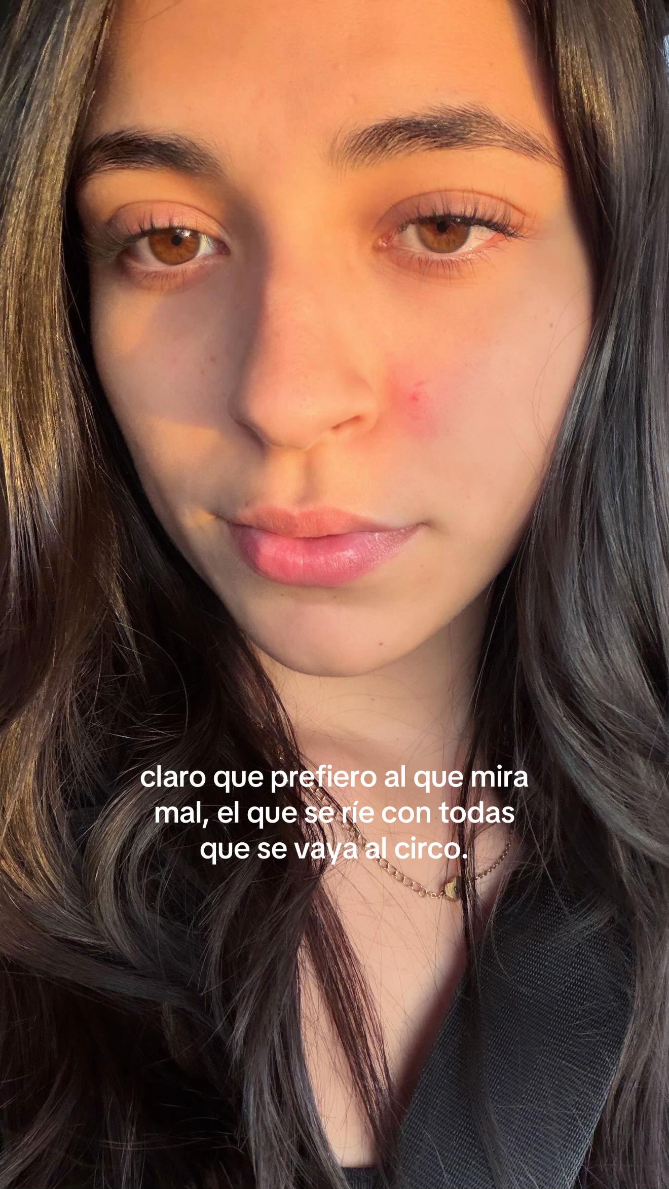@alessandra