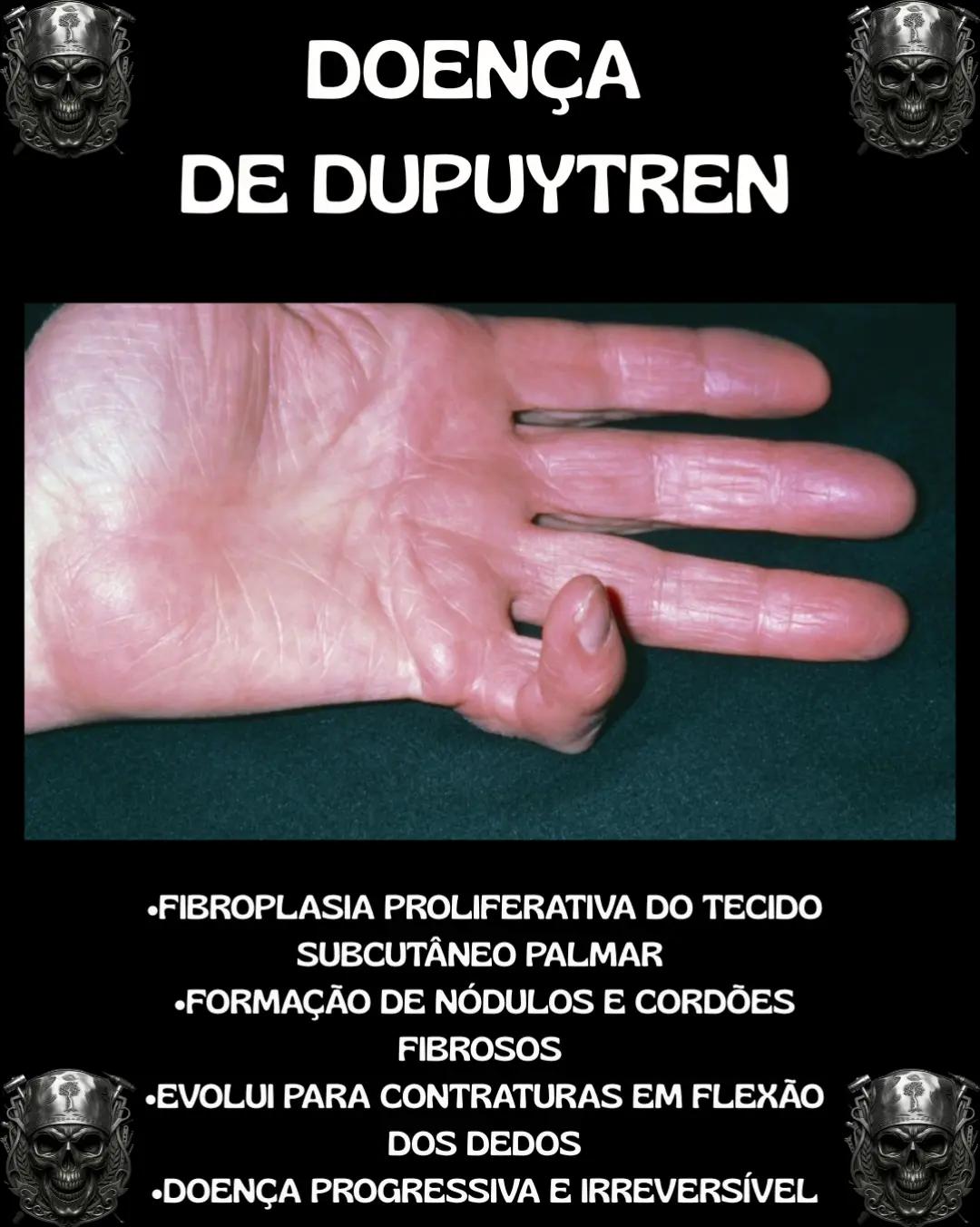 @Traumatologia Maluca