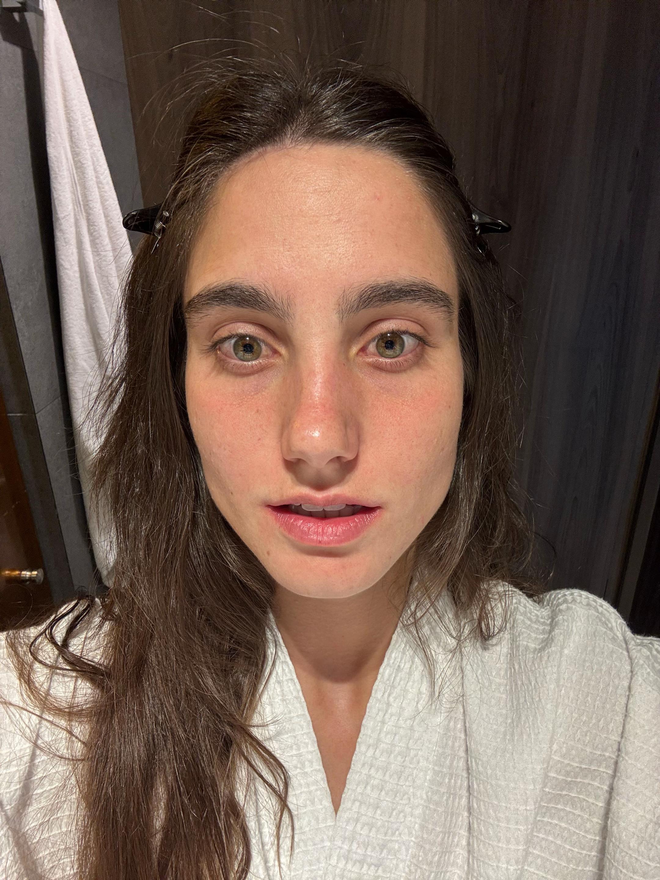 @anakloynaz
