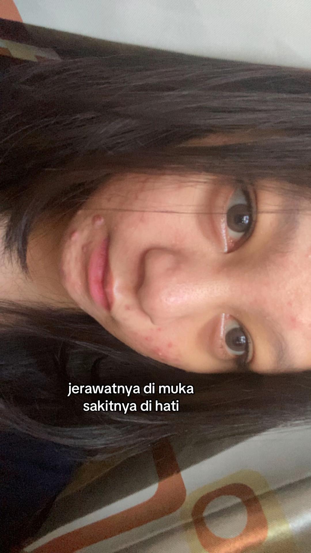 @chisin