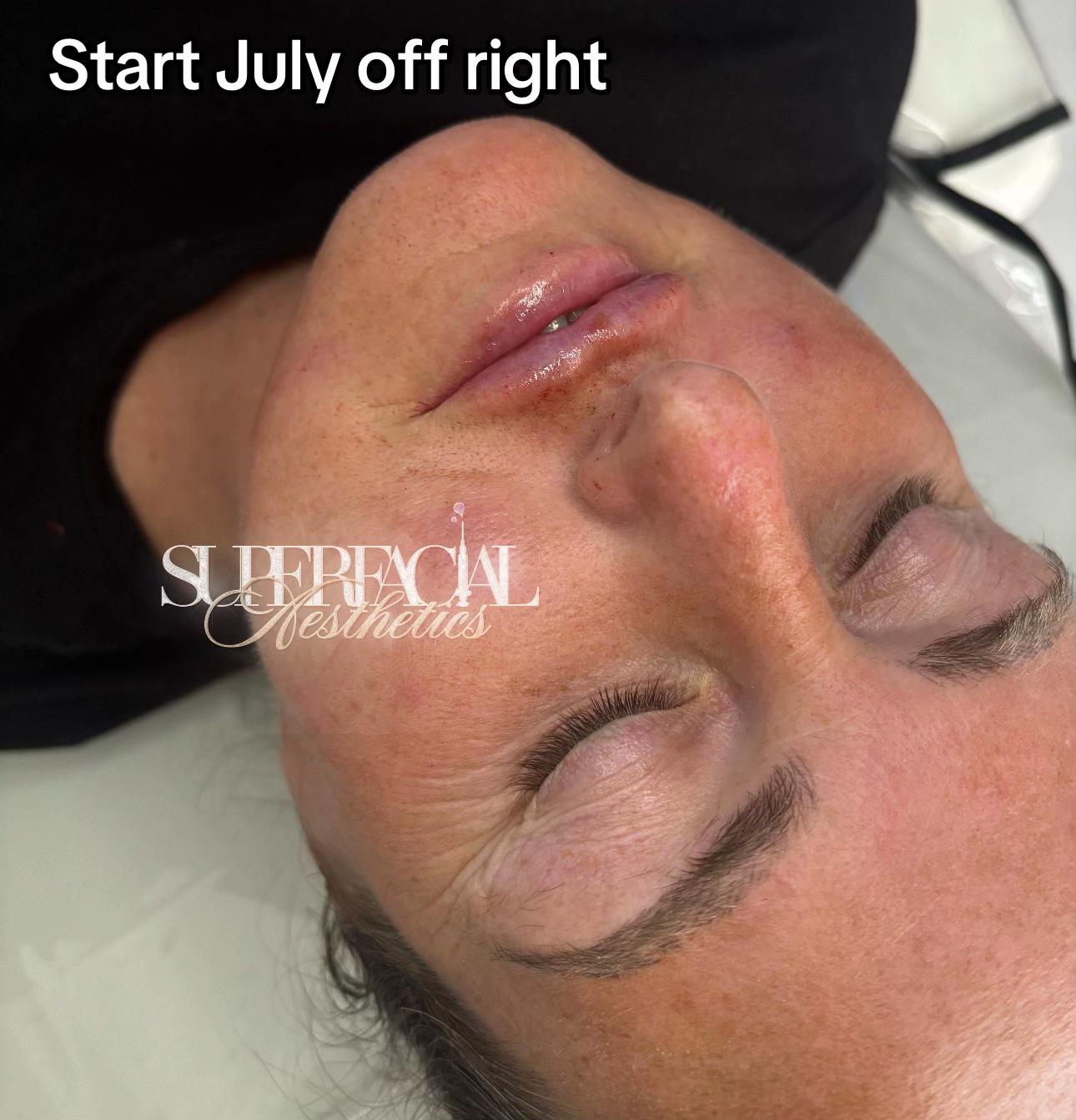 @Superfacial Aesthetics