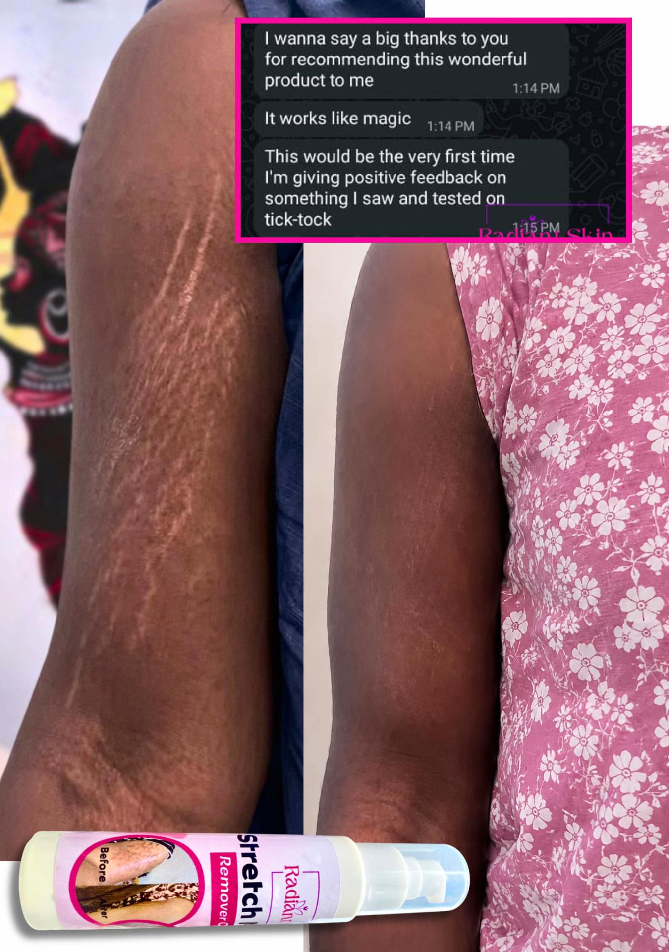 @Radiant skin