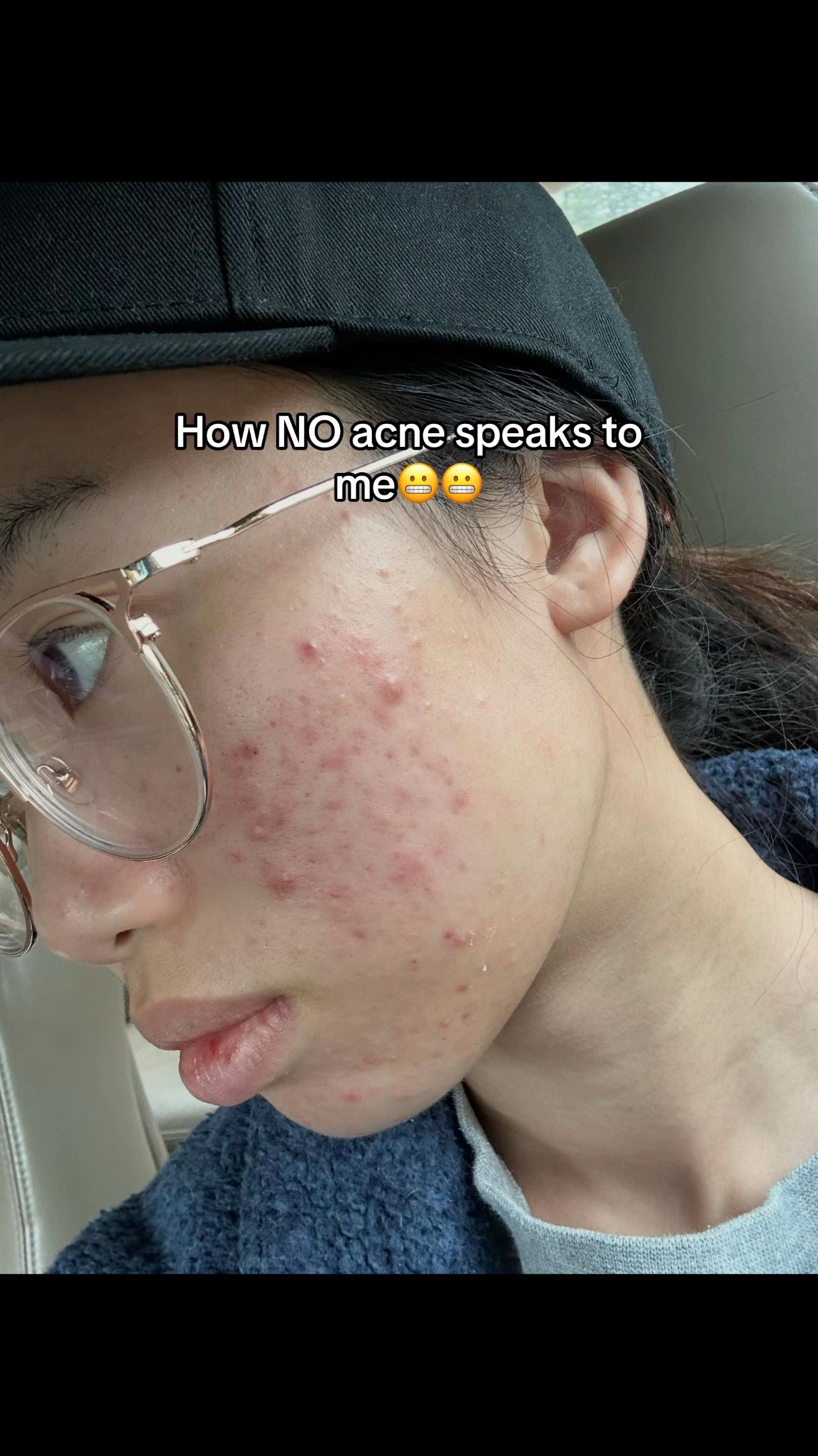 @hanawins