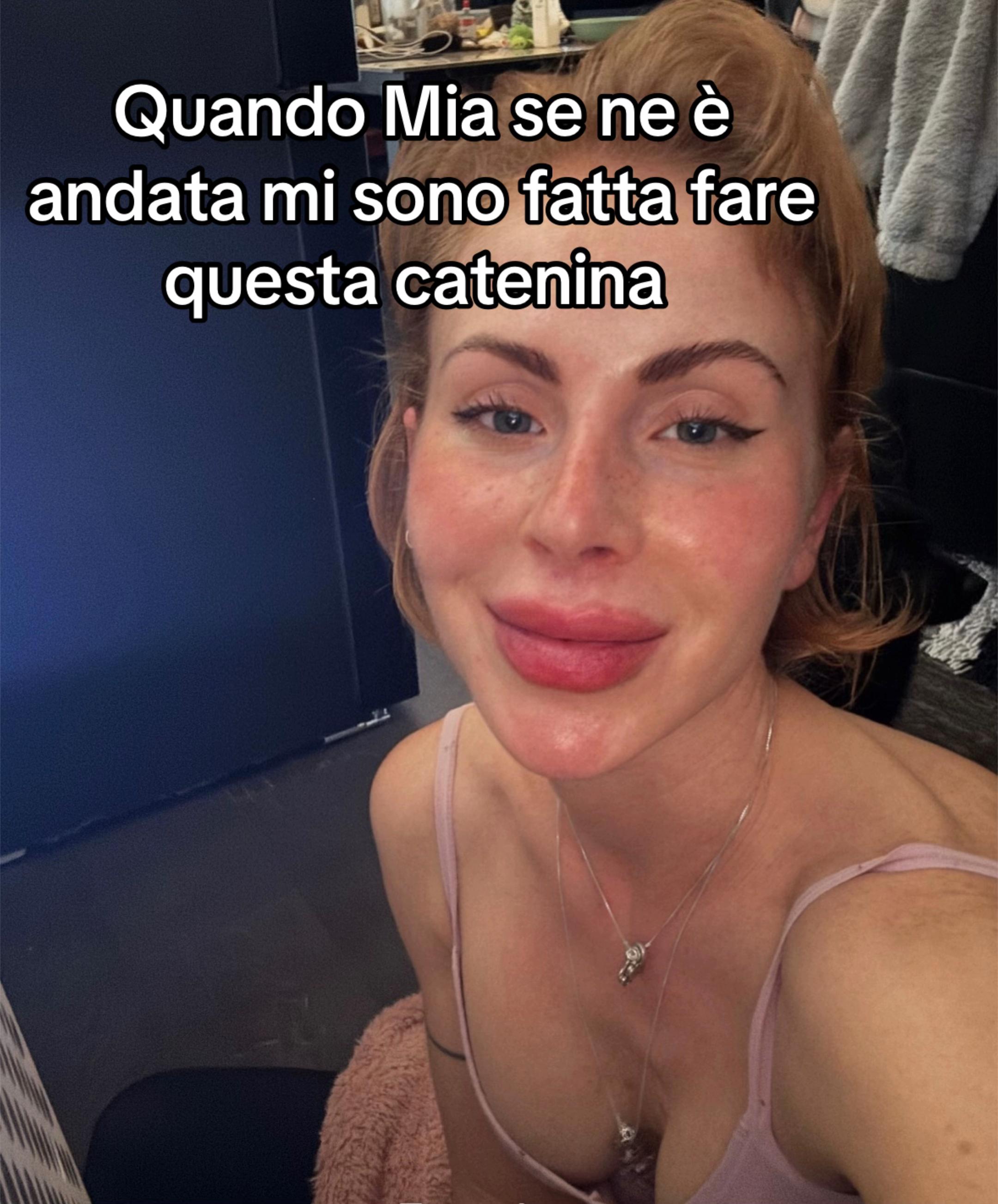 @Ashlin