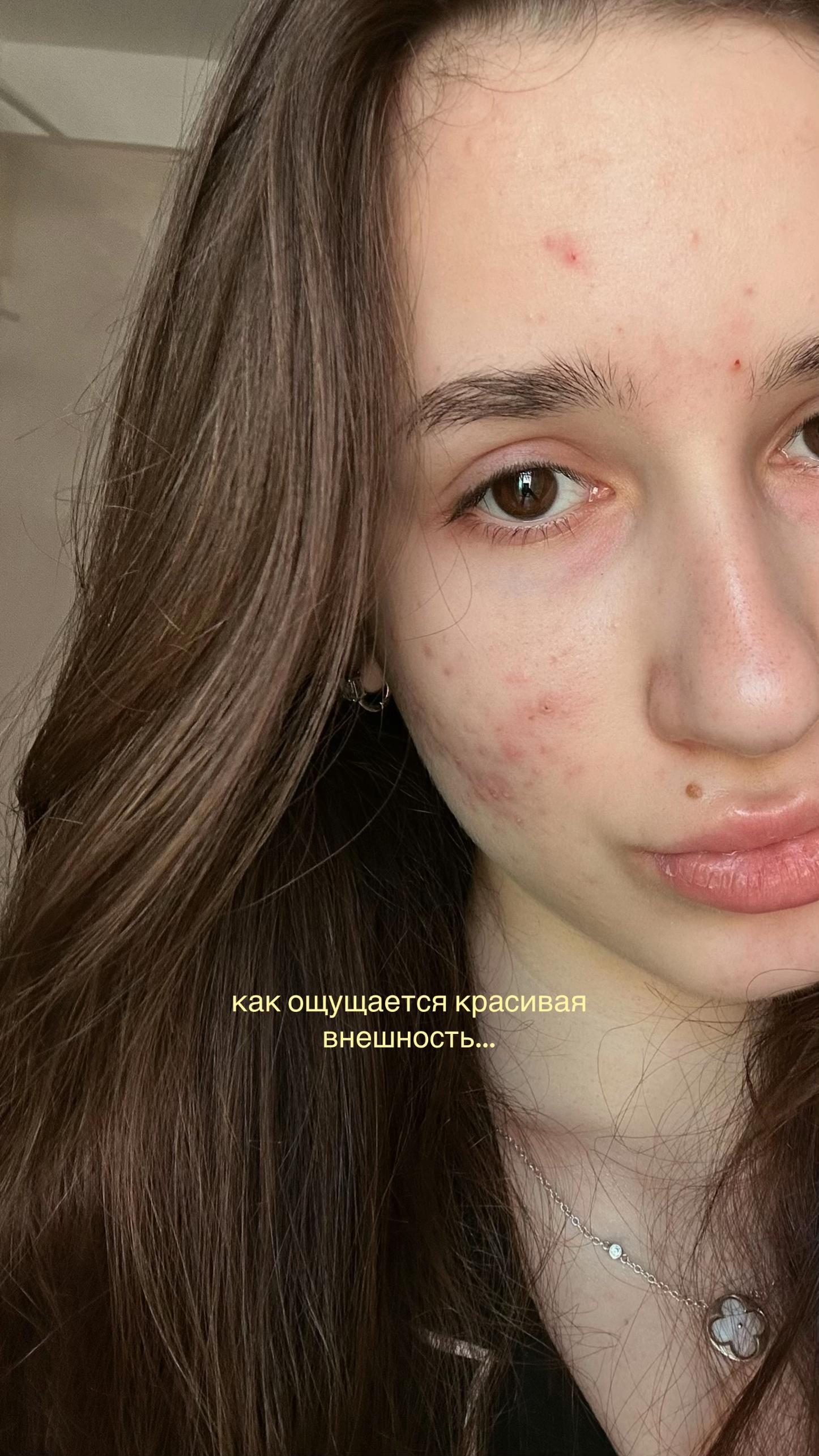 @ника аризона