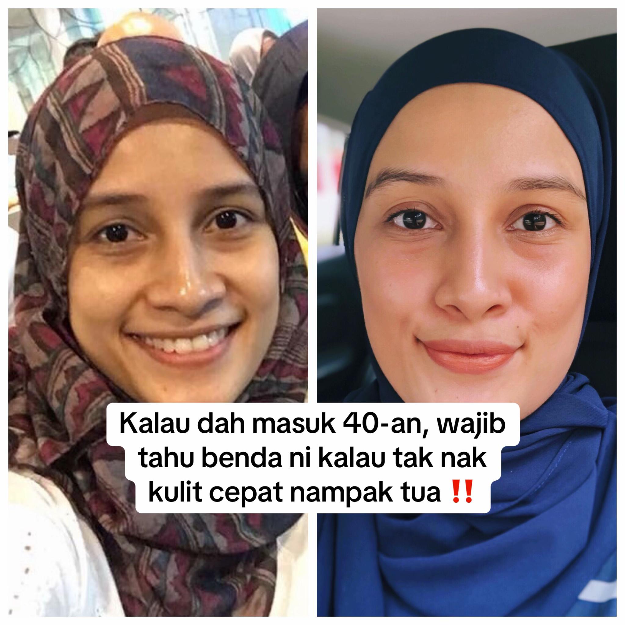 @Uyun Kamaruddin