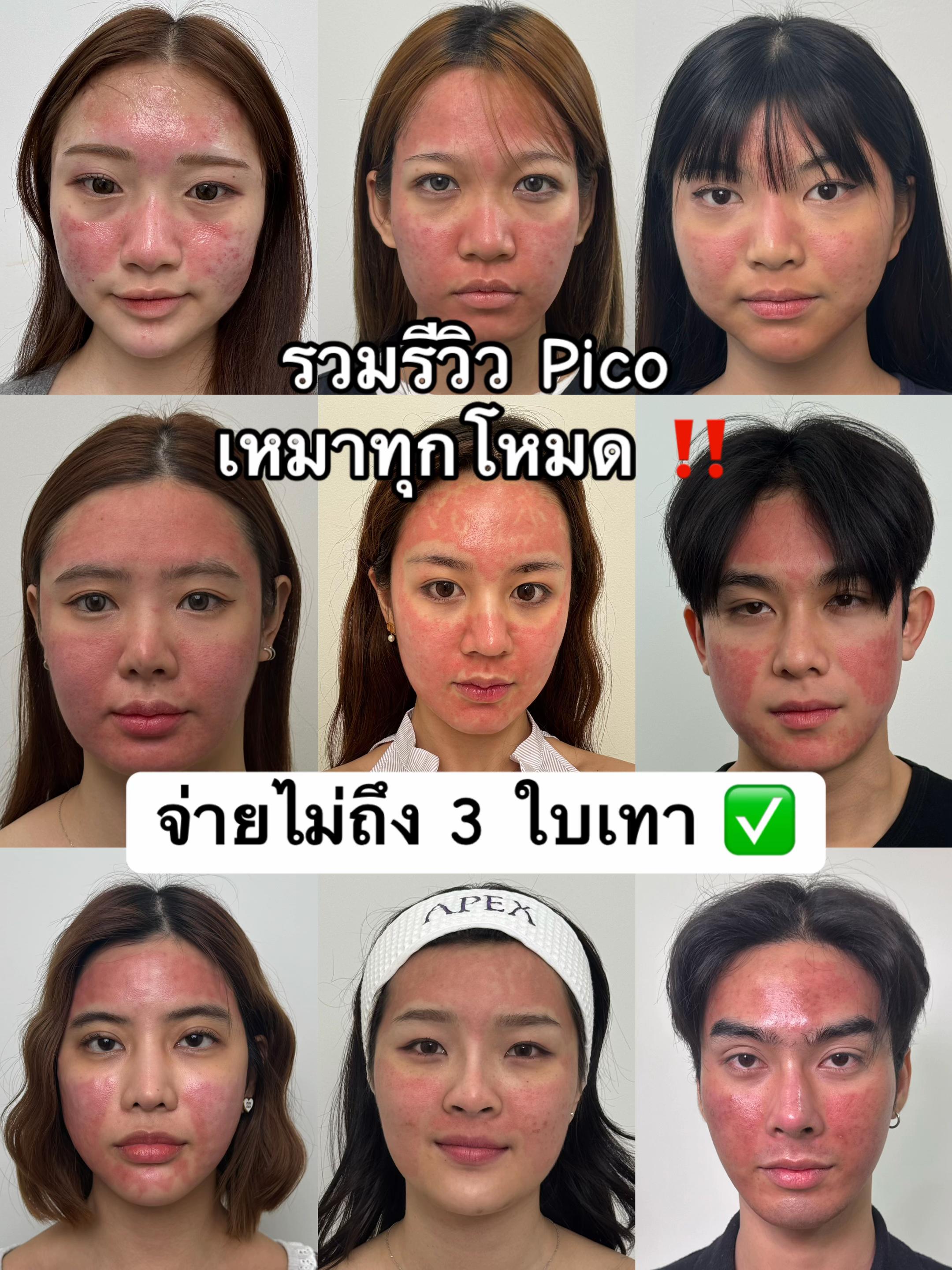 @APEXYOUNGCLINIC