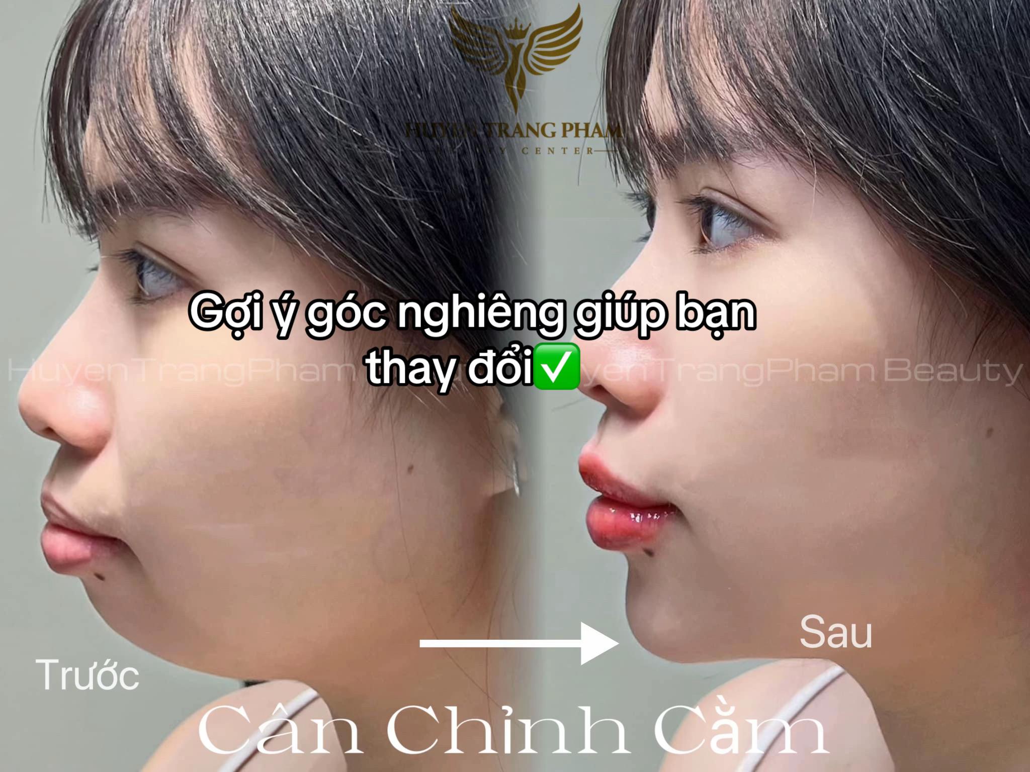@HuyềnTrangPham Beauty