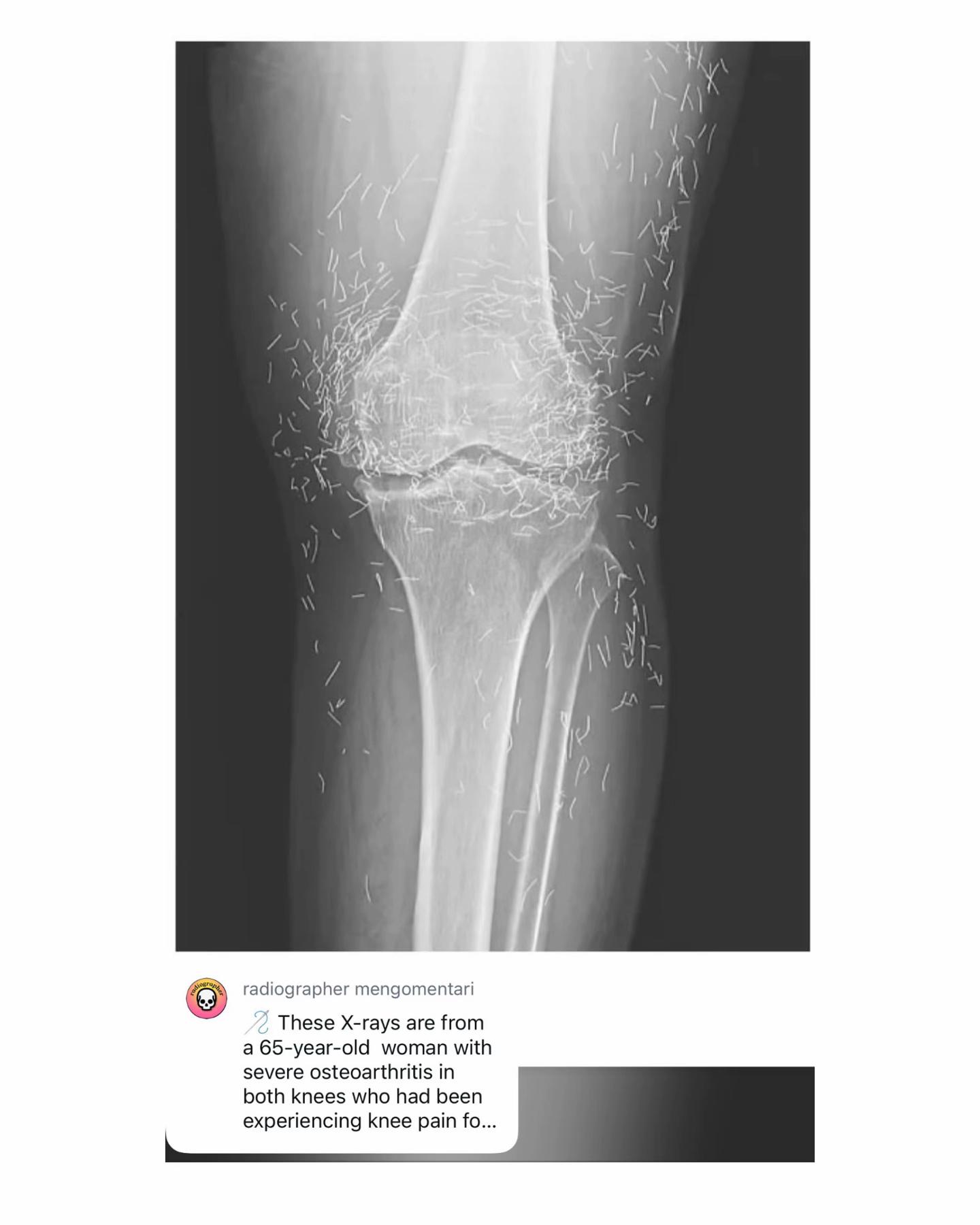 @Sobat Radiology