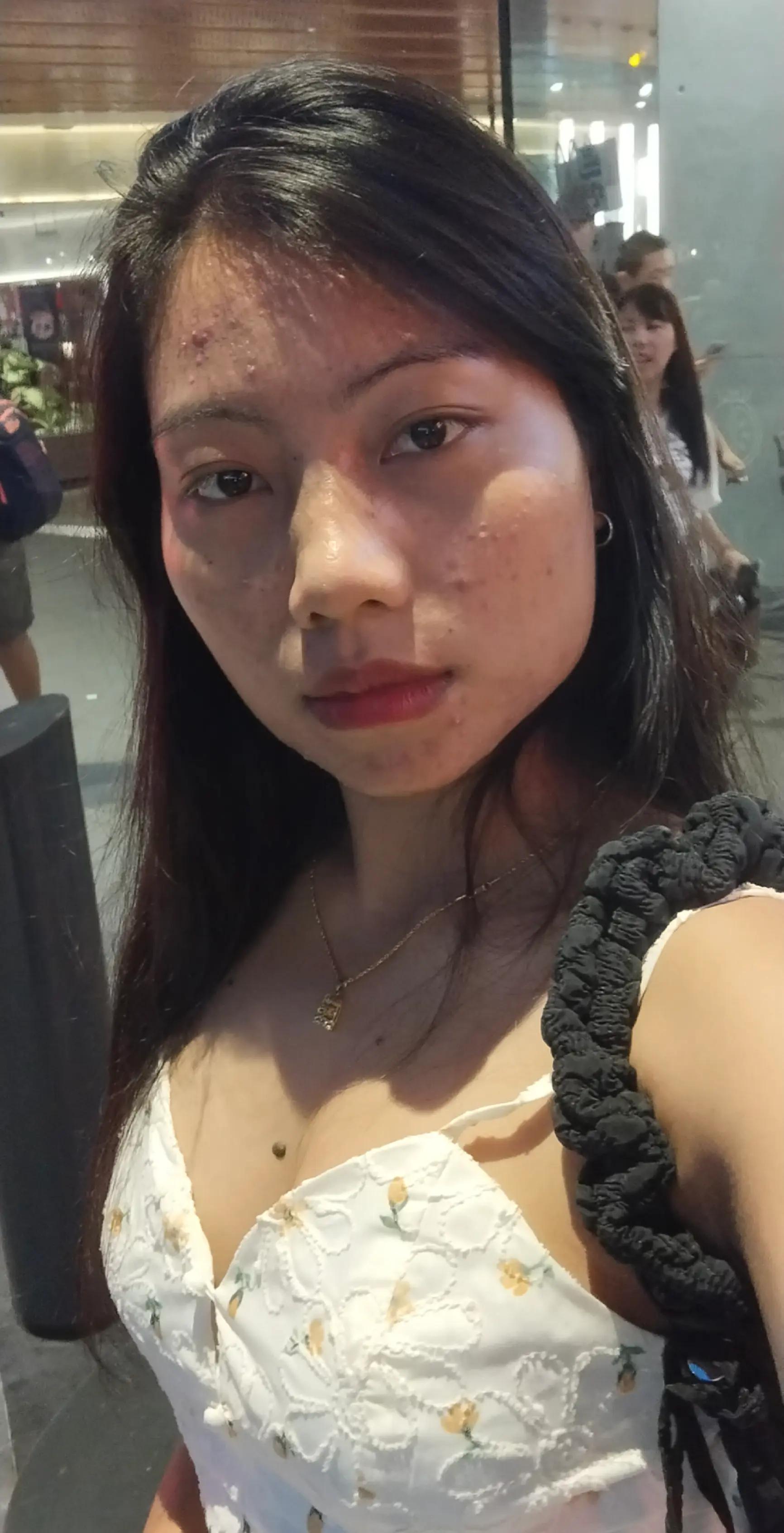 @Lalnonoi