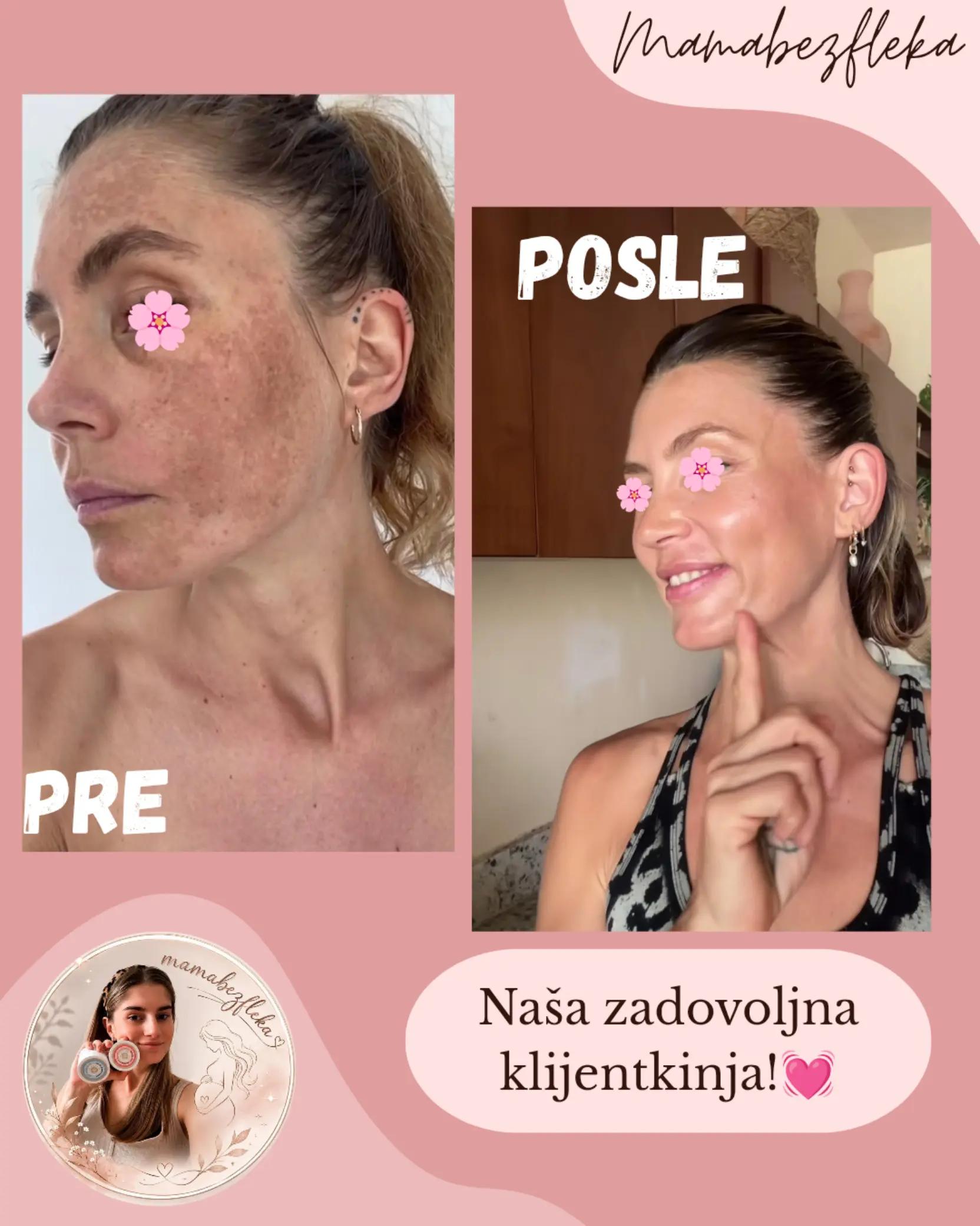 @Mama bez fleka