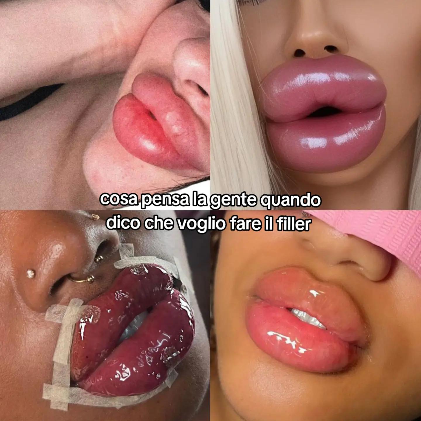 @•RACHELE🍒
