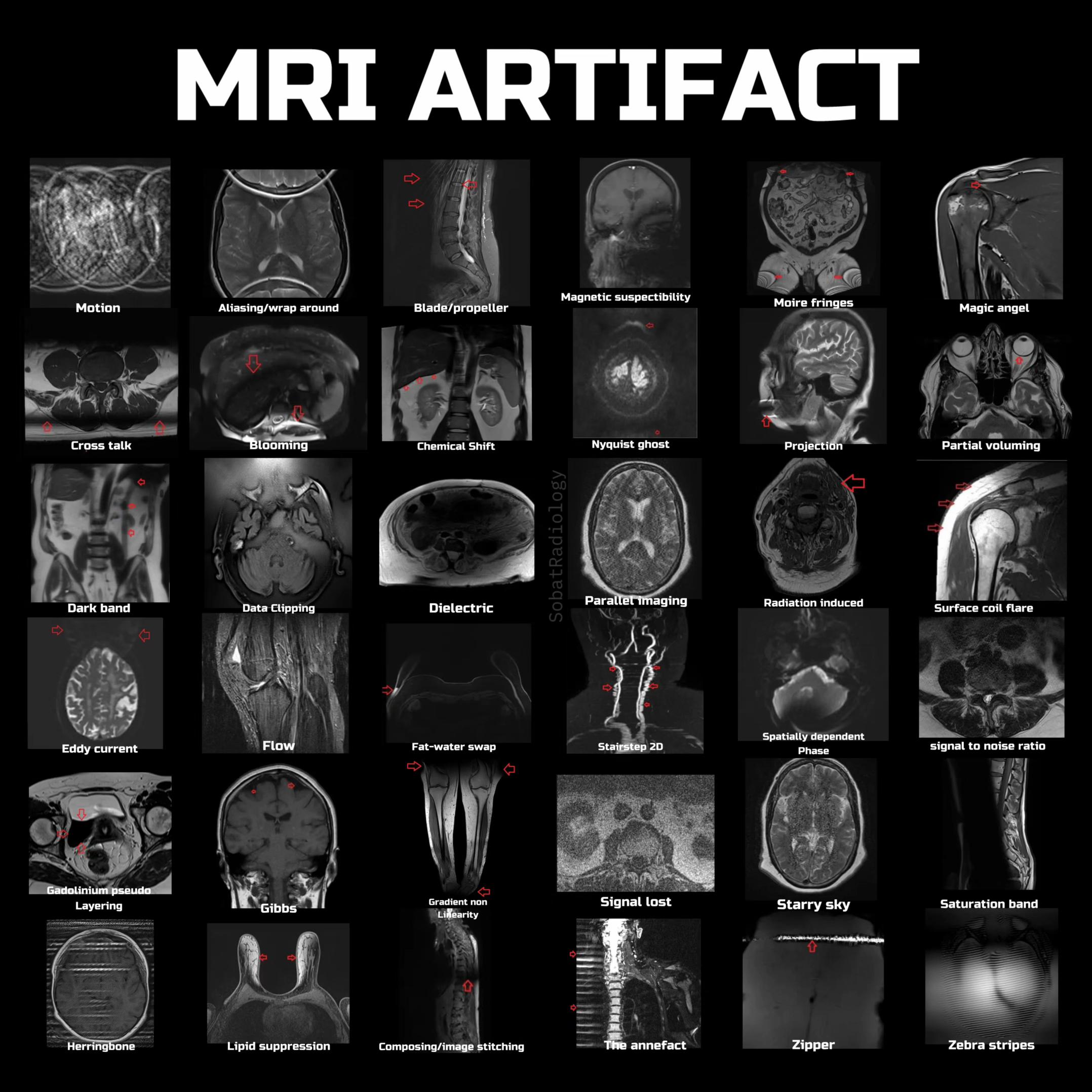 @Sobat Radiology