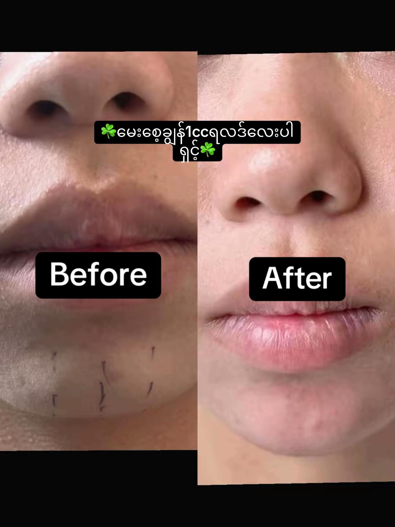@JaJa (April Nu Beauty Clinic)
