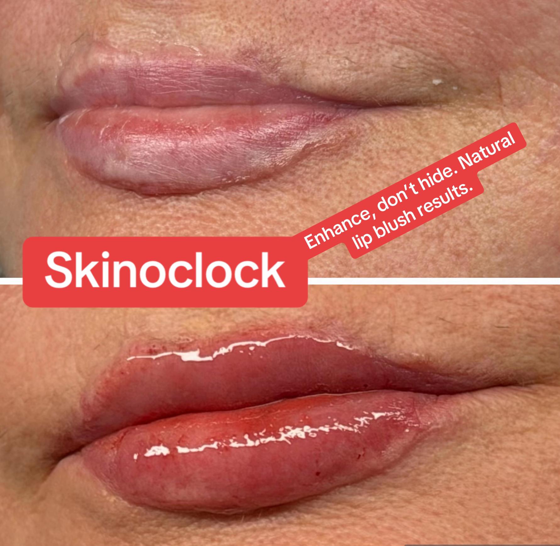 @skinoclockuk
