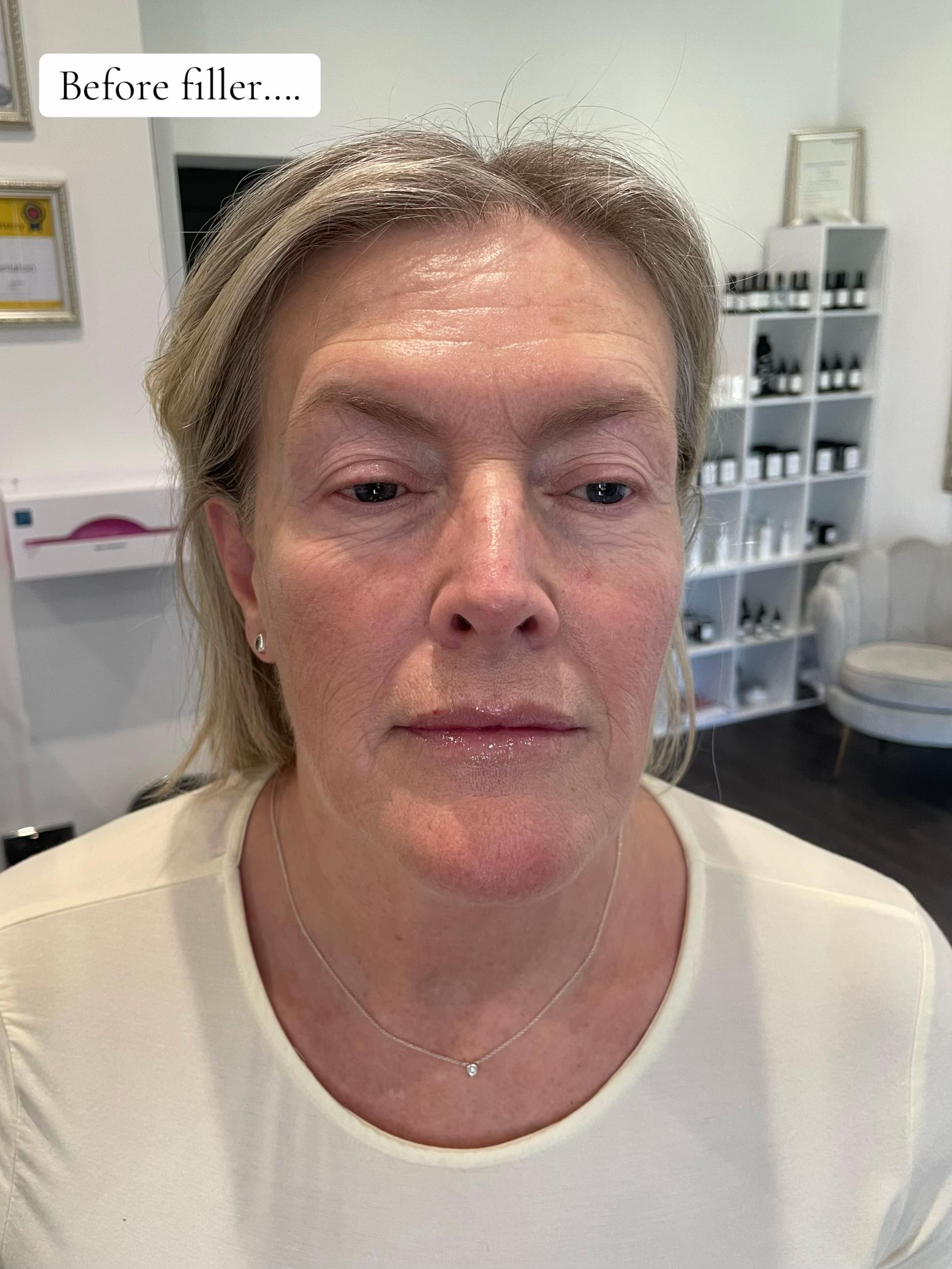 @Brows & Aesthetics by Lou