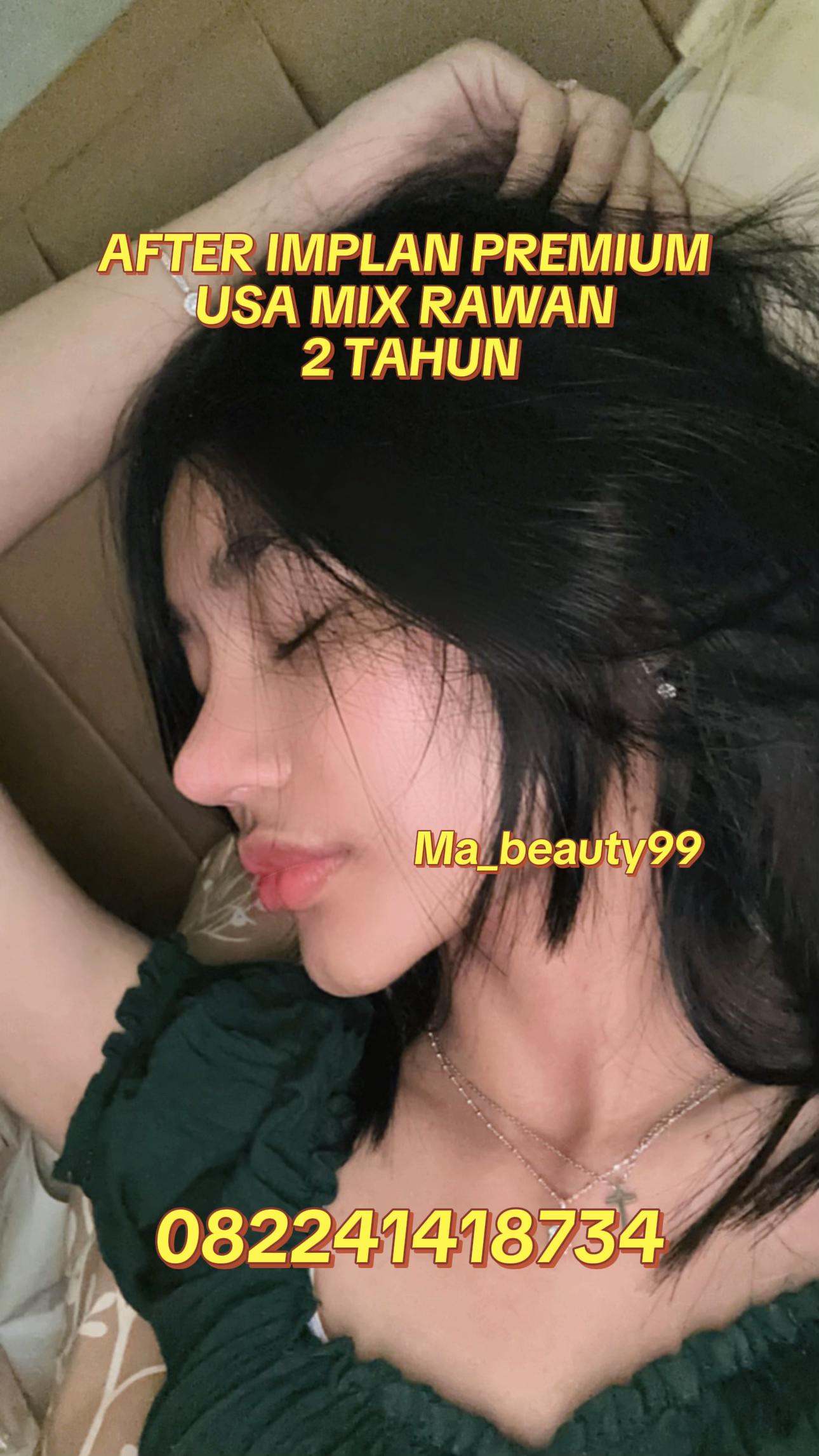 @MA BEAUTY 99