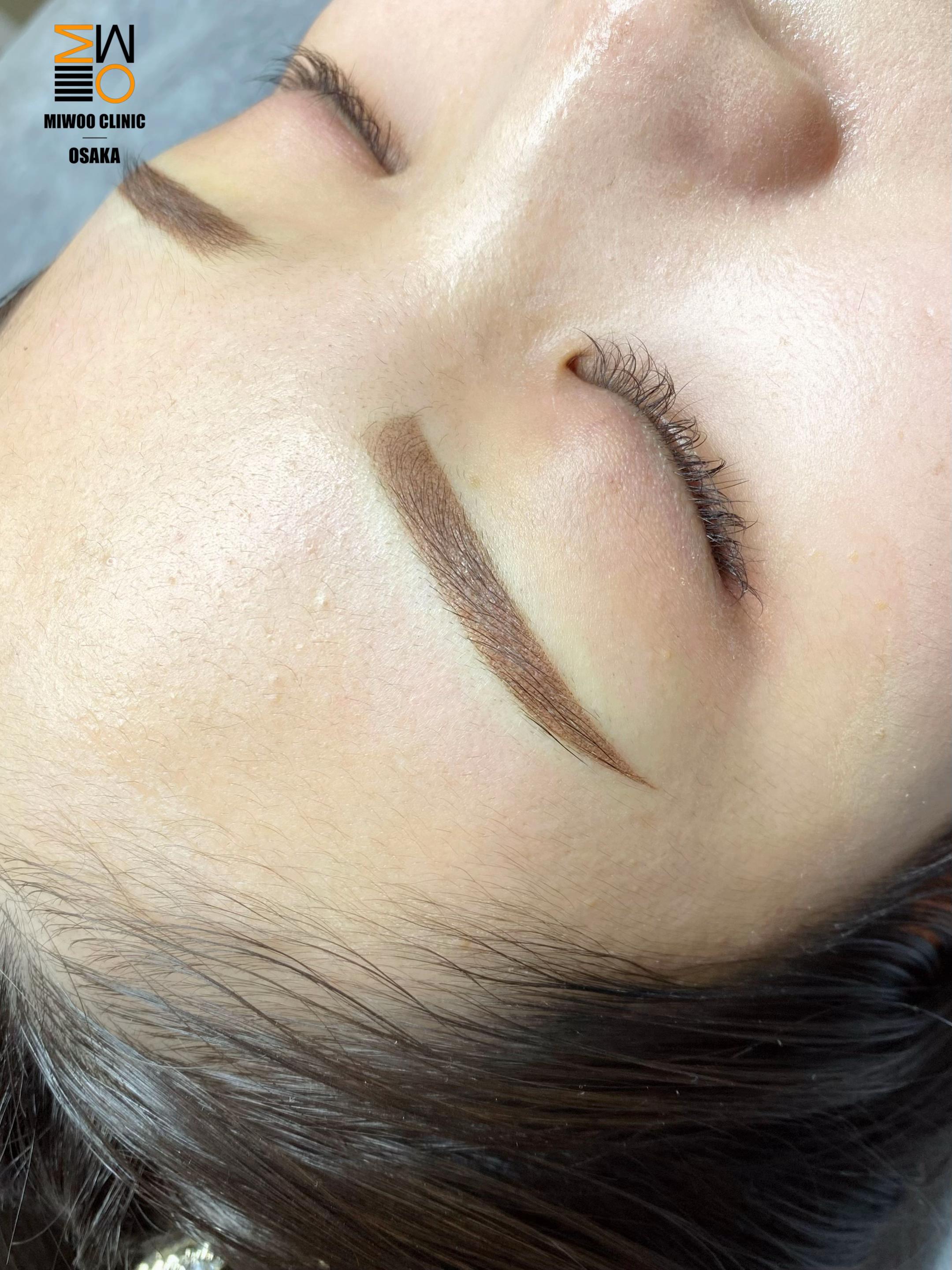 @MIWOO_CLINIC 大阪院