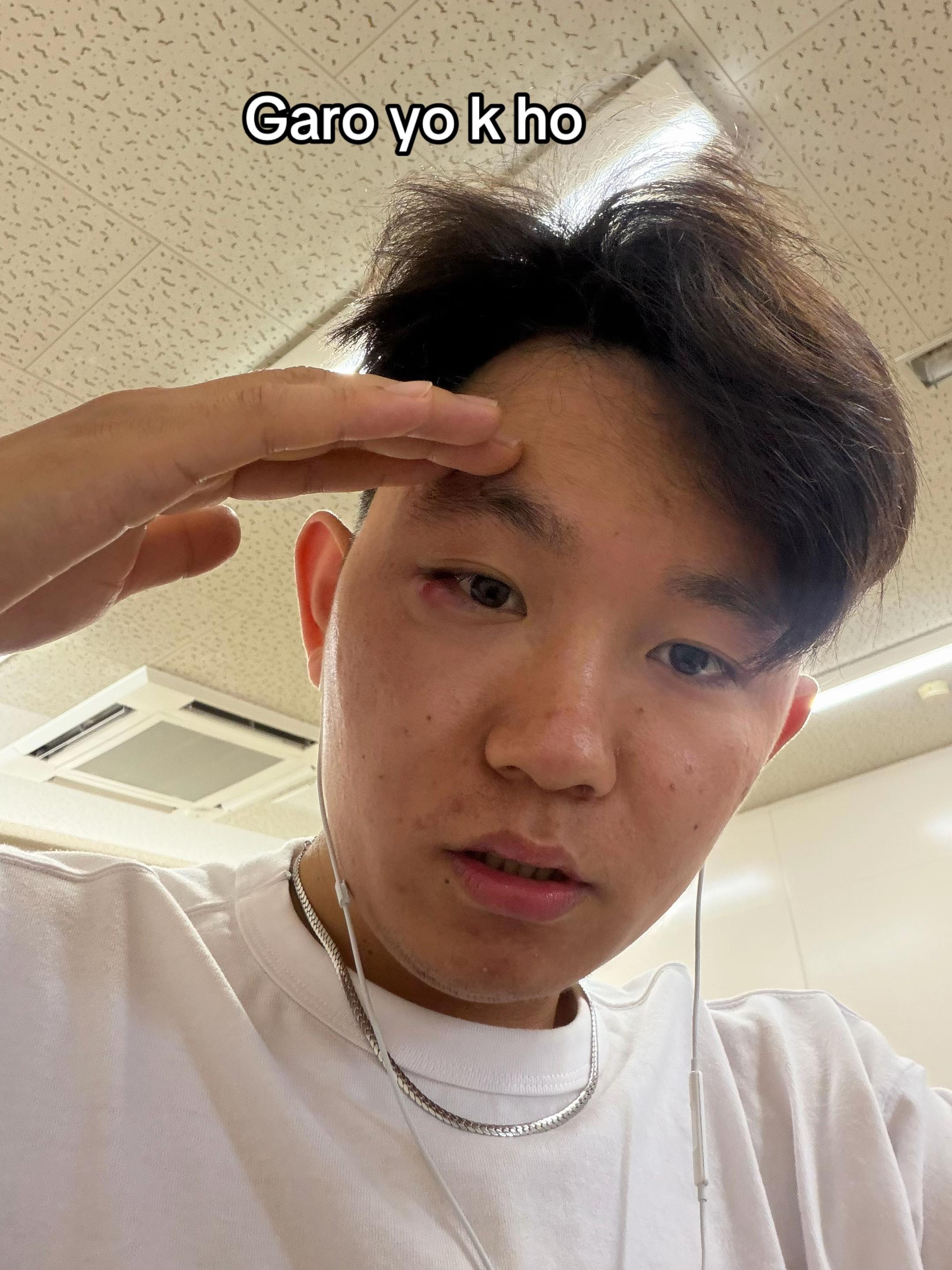 @EG VLOG