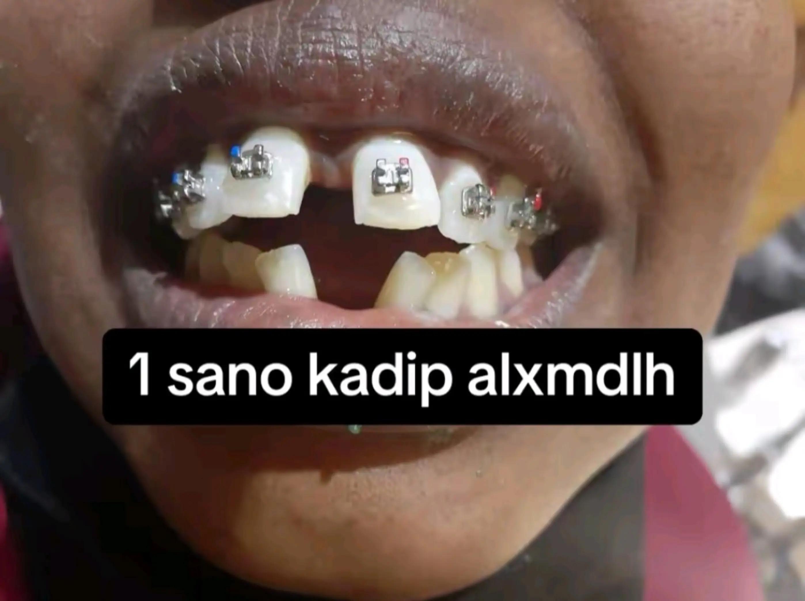 @Dr.Naasir🦷🩵🩺