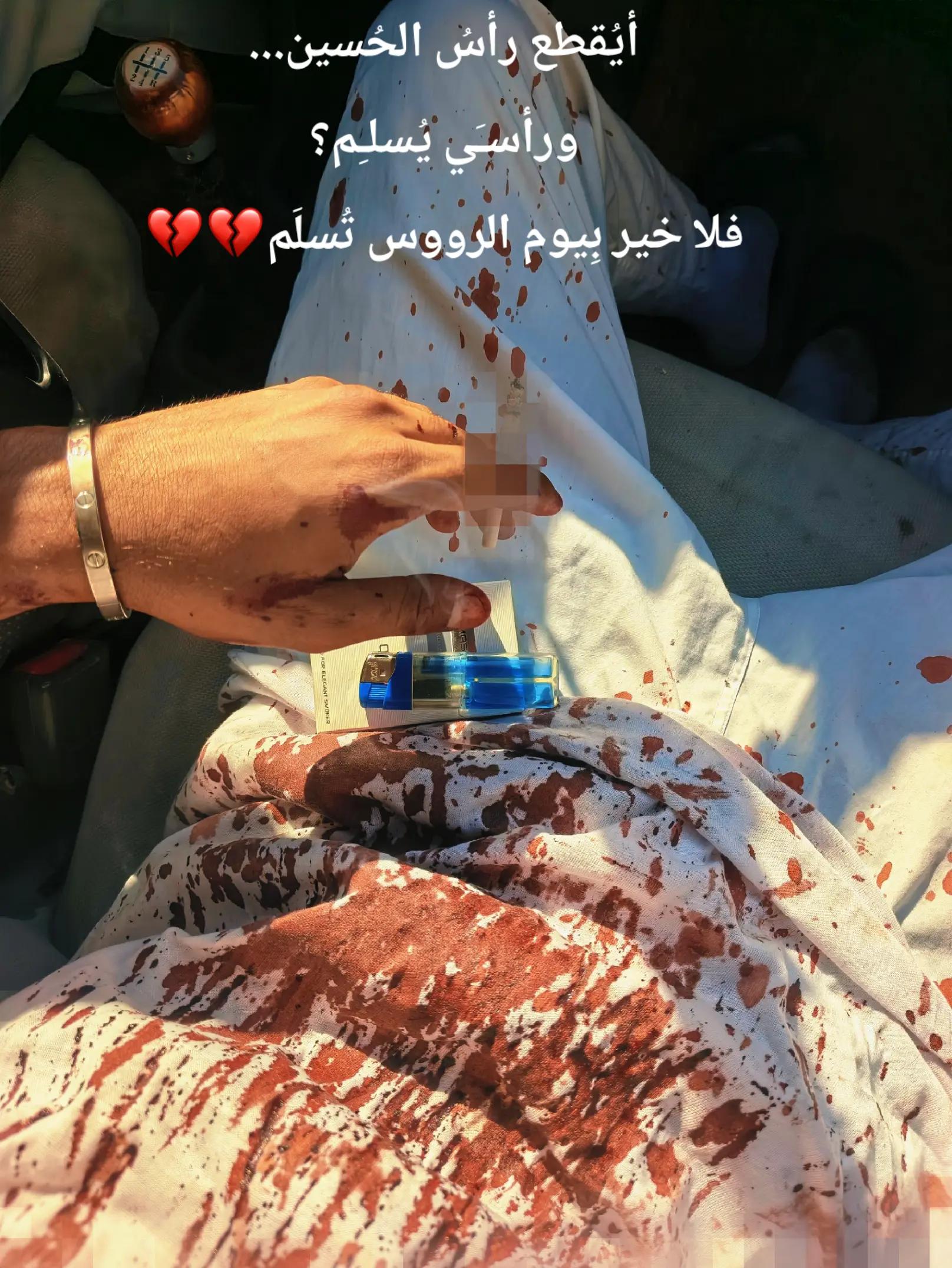 @أمـيـرࢪ 🩶🍂&deg;&middot;.