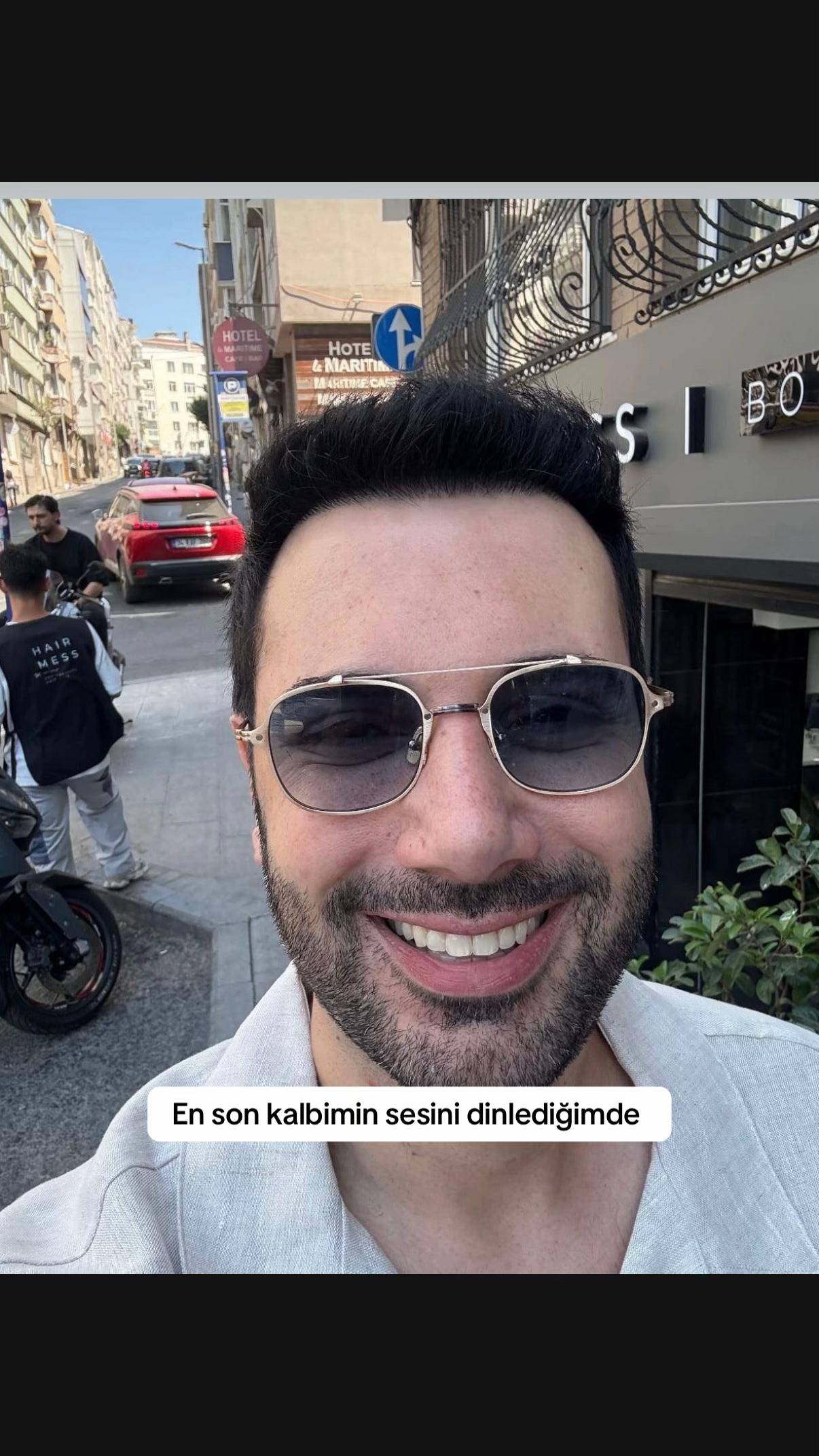 @Onur Sermik
