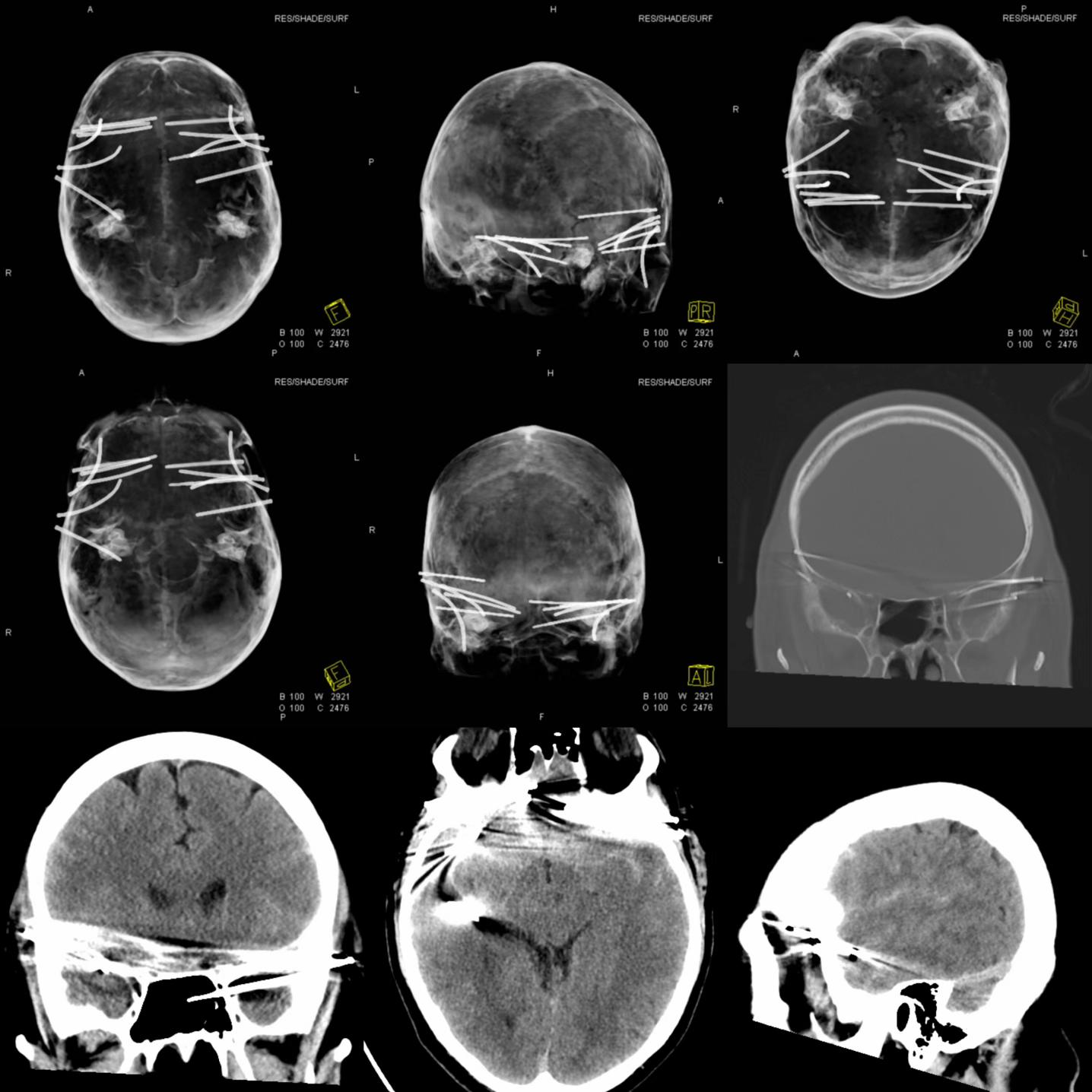 @Sobat Radiology