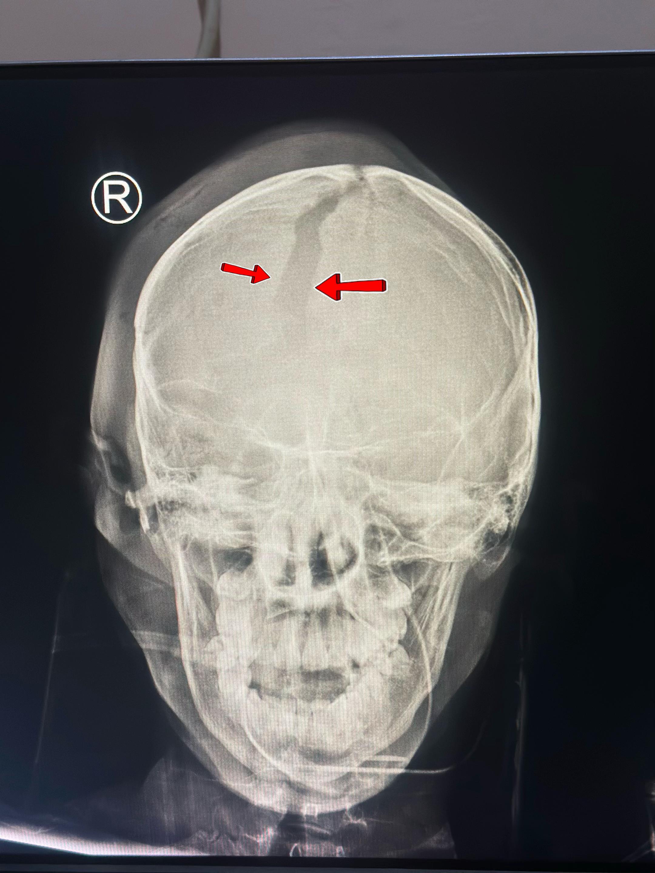 @Sobat Radiology