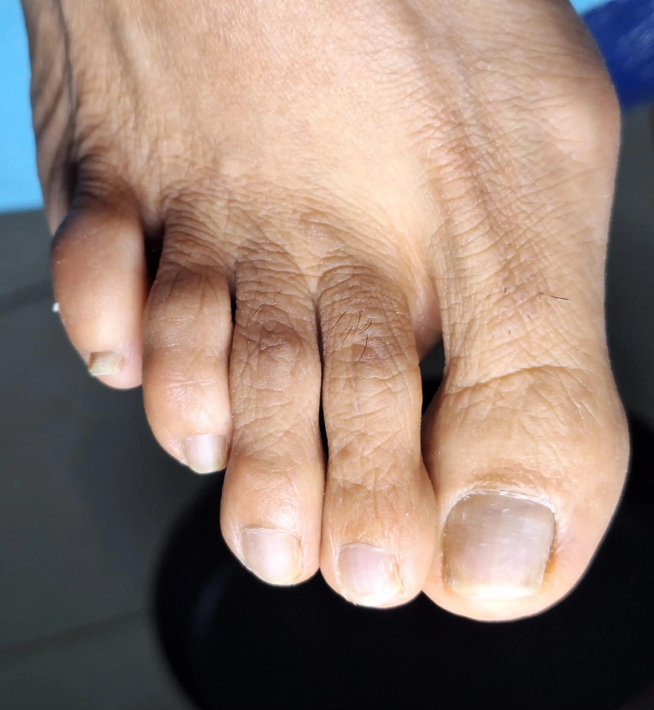 @Quiropodia HAPPY FOOT🇨🇷