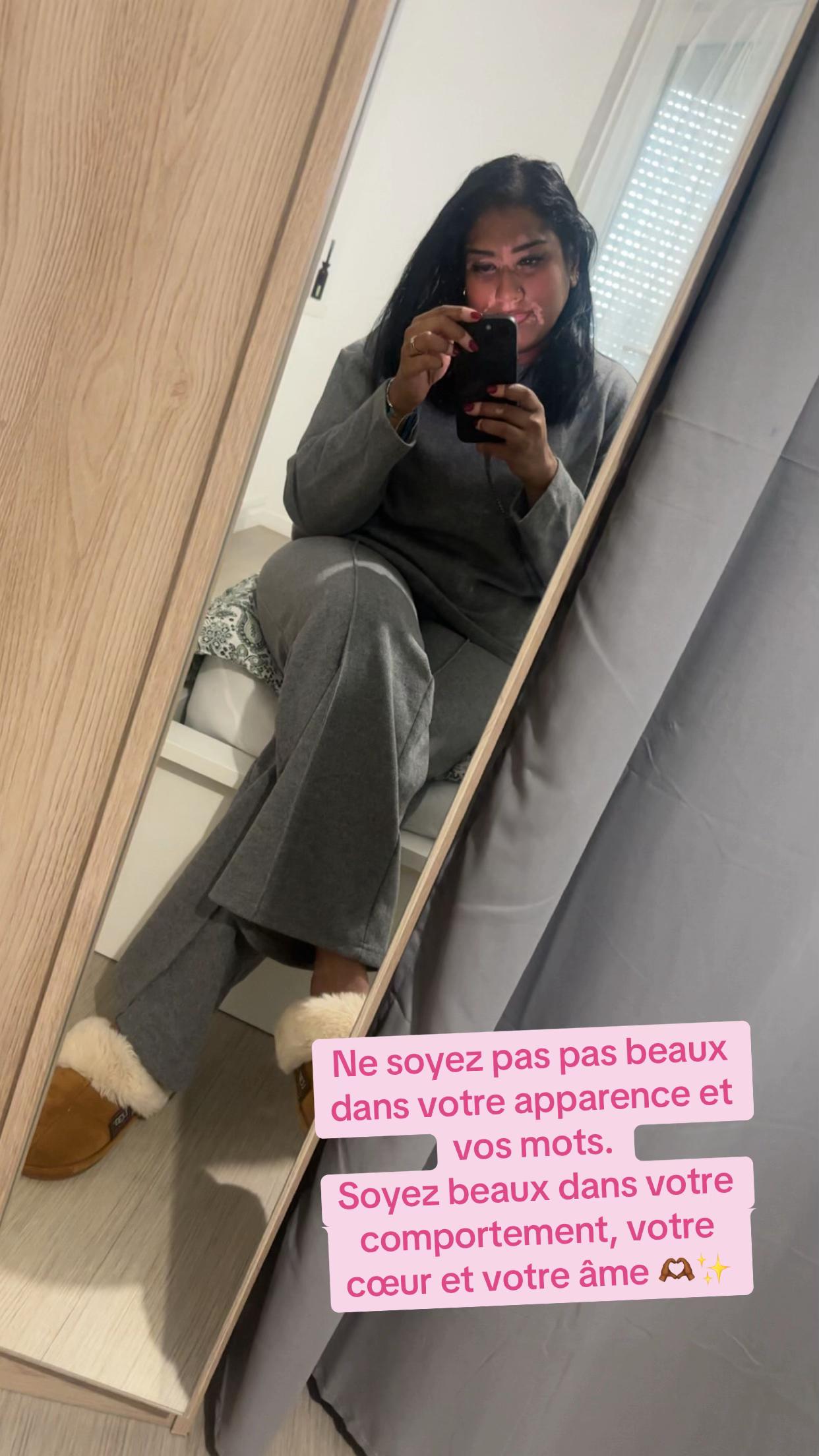 @Mimie | Vitiligo 🤍🌸