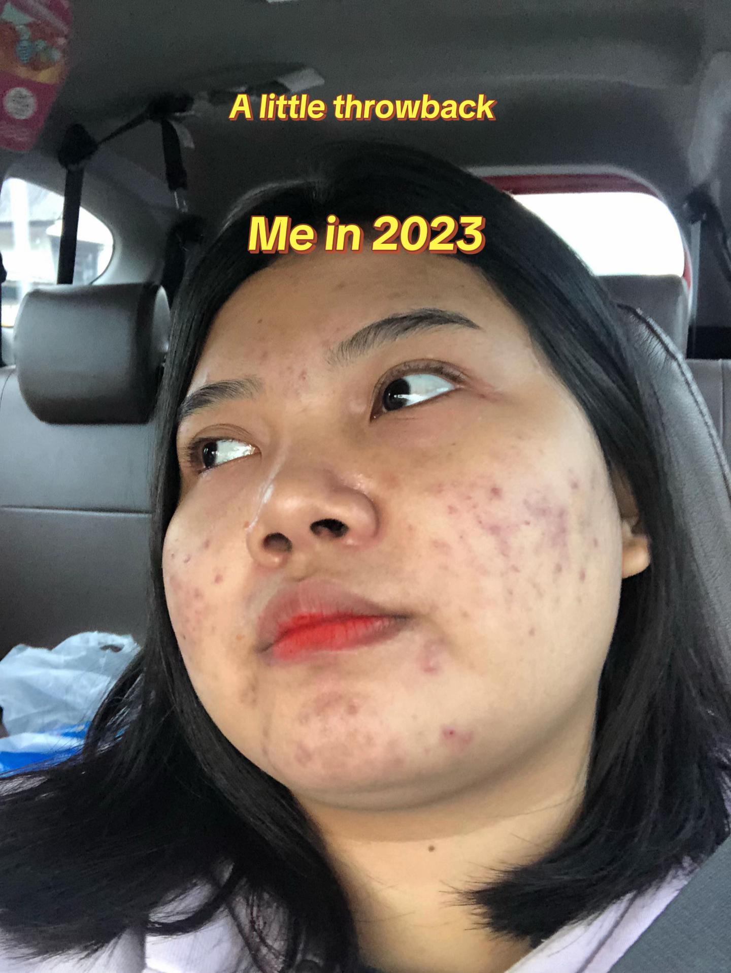 @ichi | glow up journey