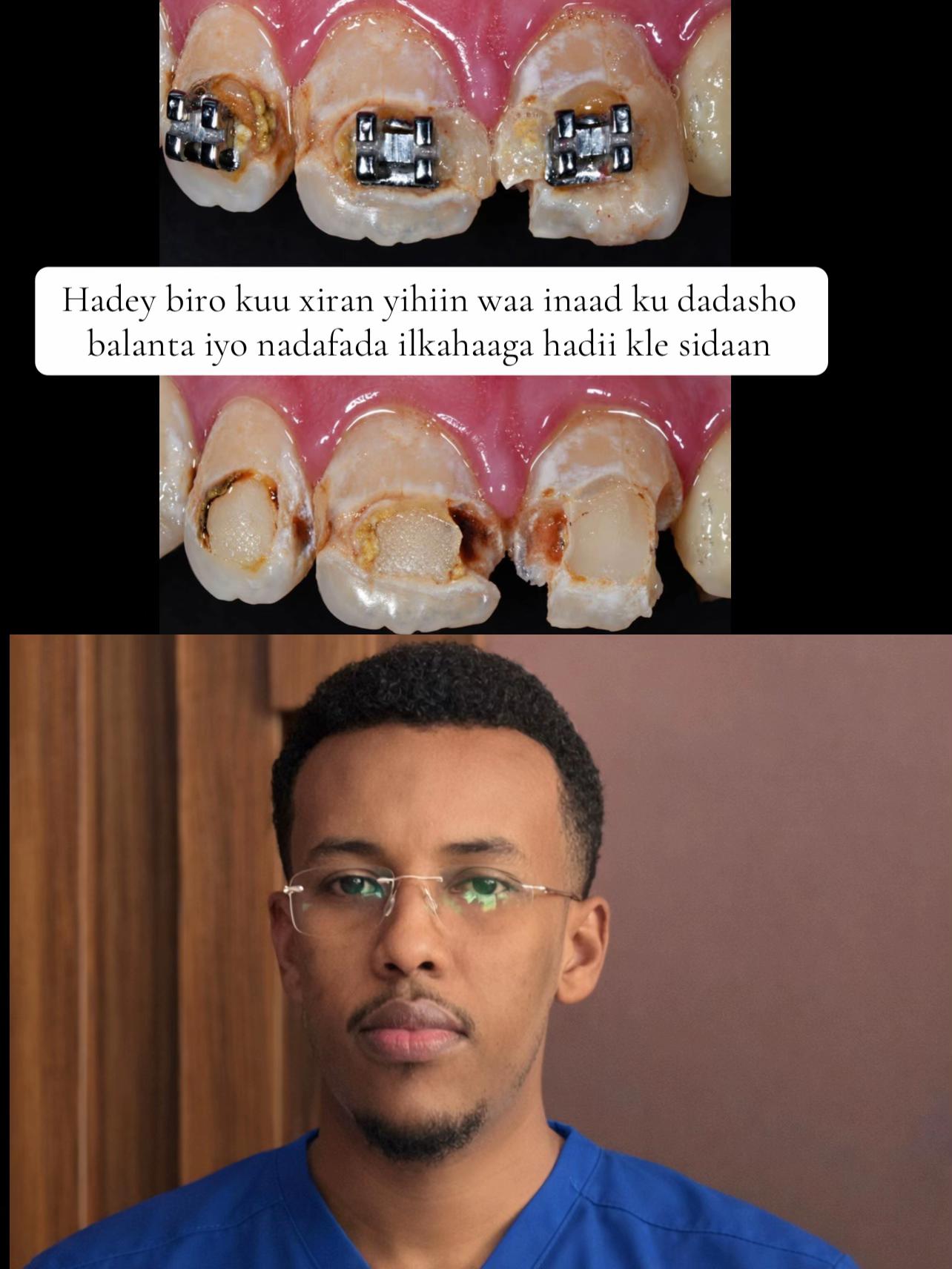 @Dr Abdirahman hassan laari
