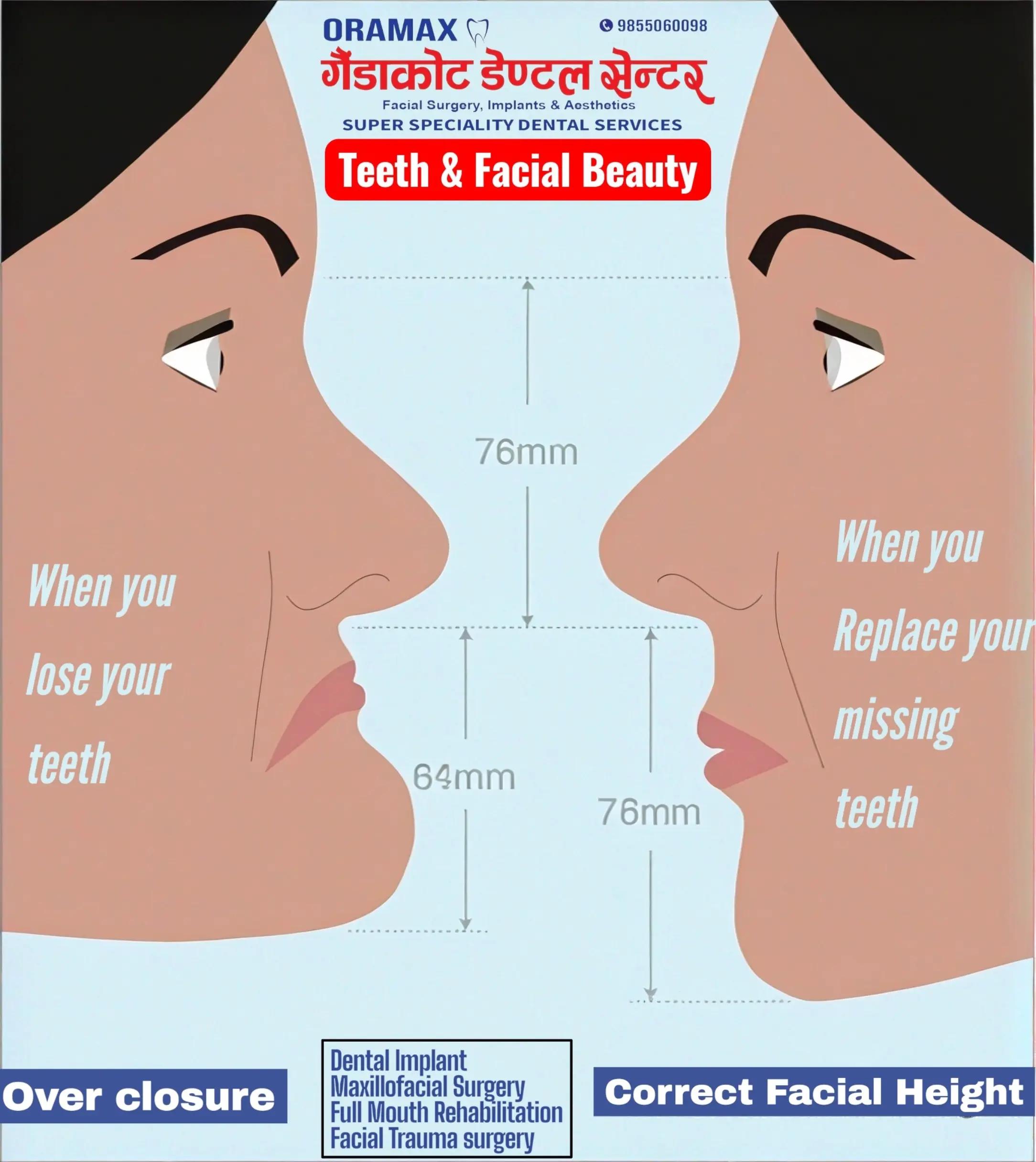 @Dr. Krishna Regmi-MDS (OMFS)