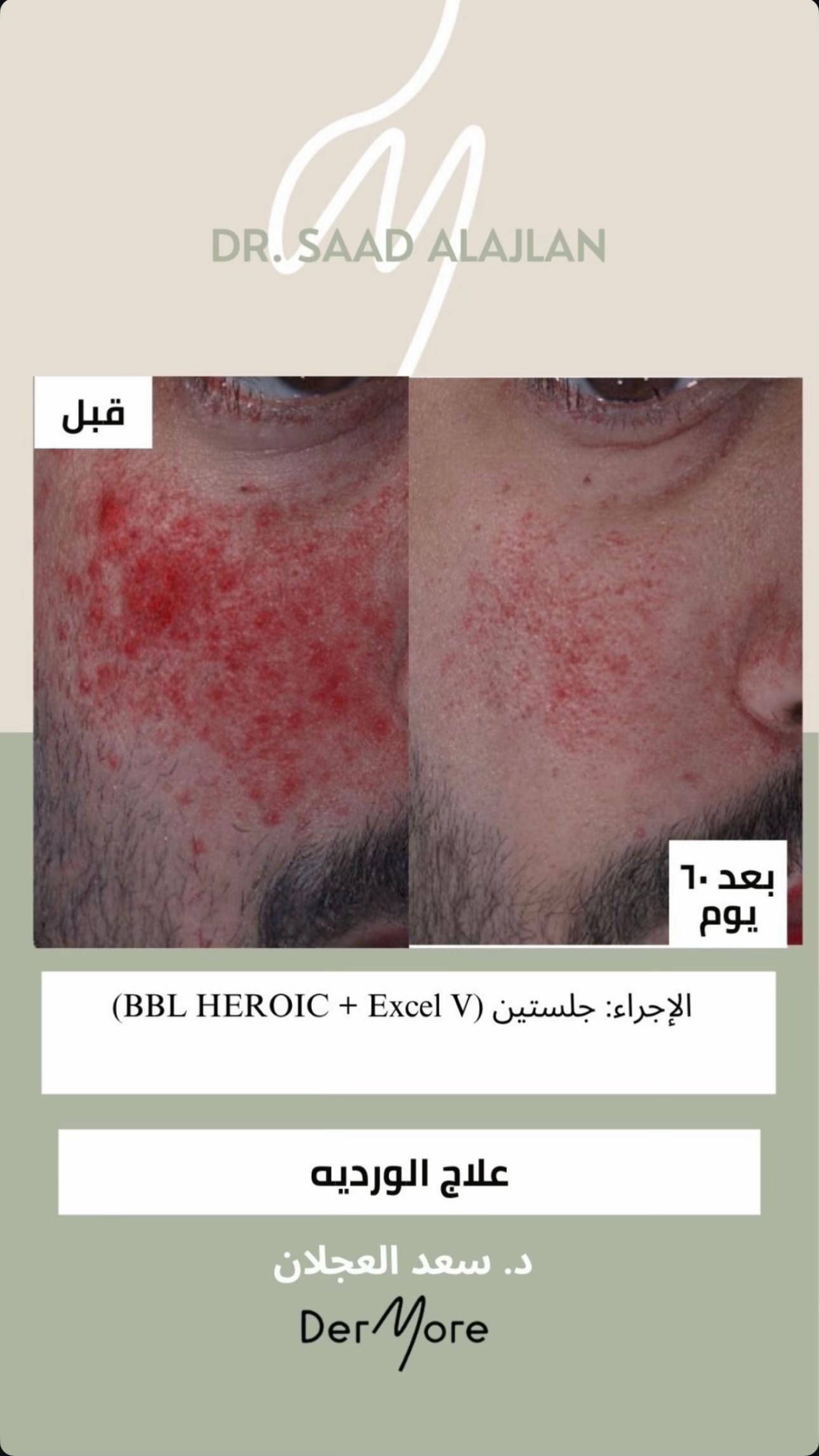 @د. سعد العجلان | الرياض 🇸🇦