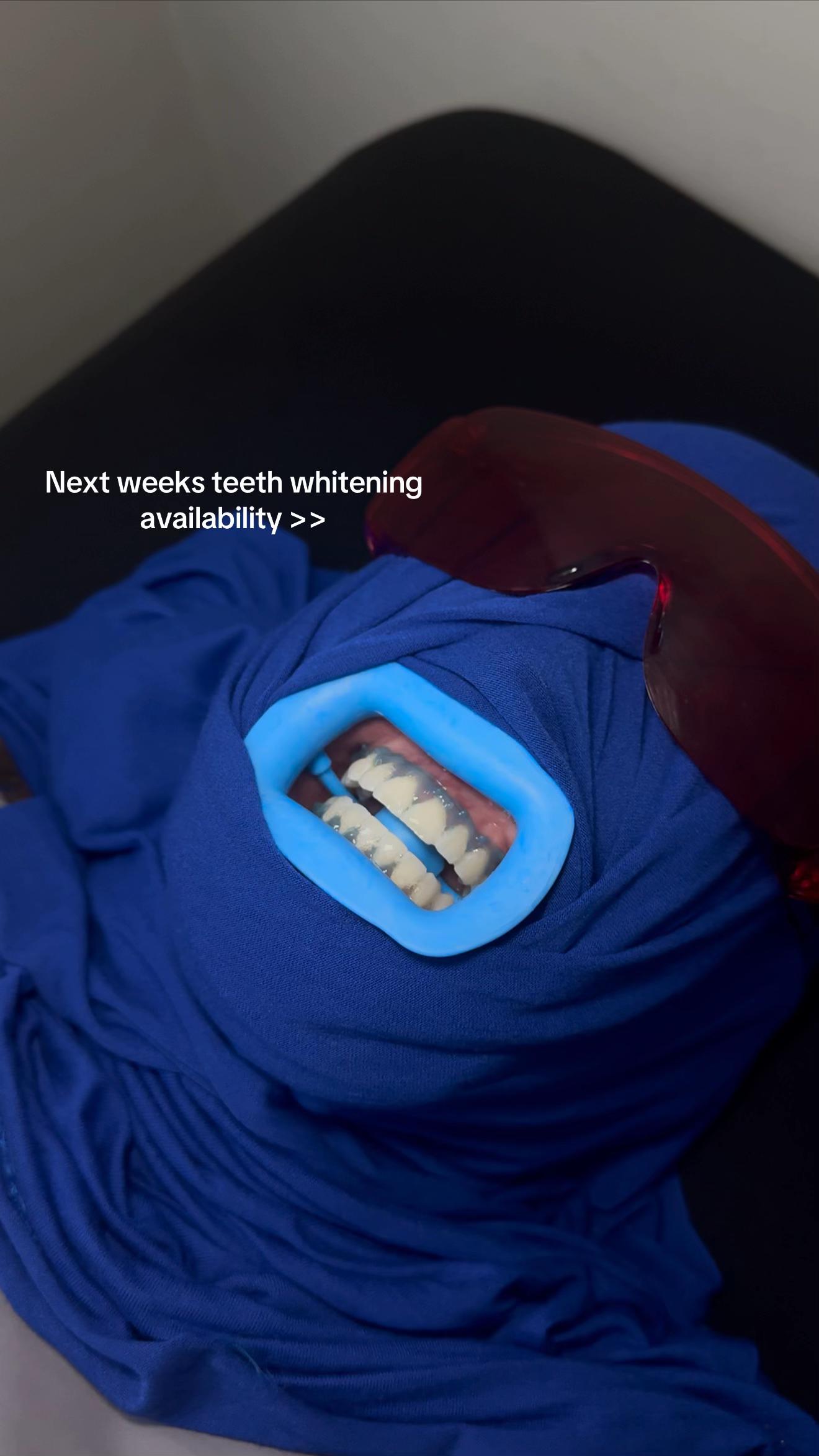 @Halal Teeth Whitening London