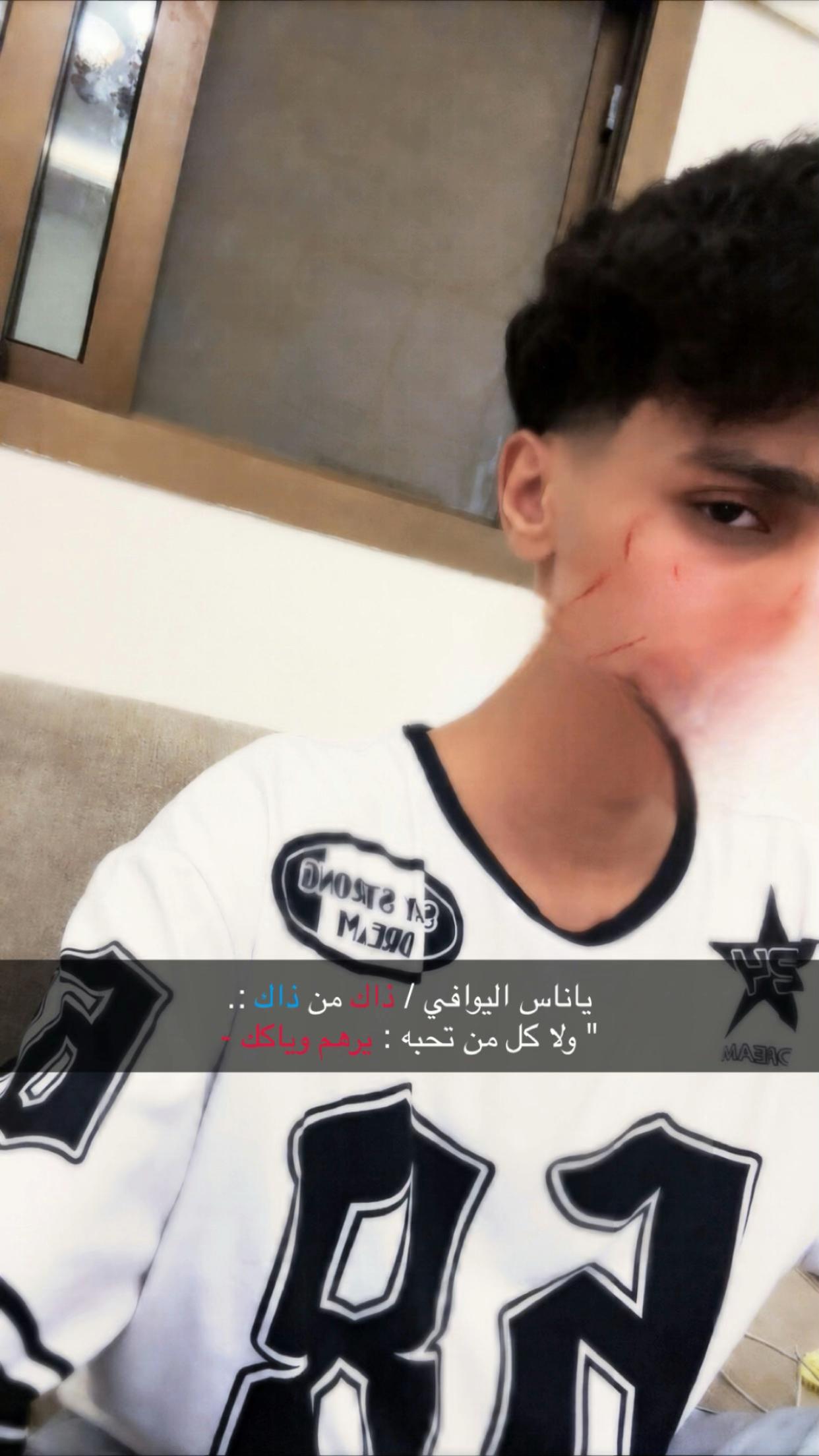 @Al-zahrani
