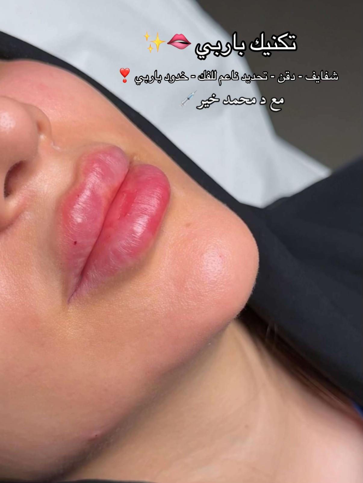 @Dr. Mohamed khier