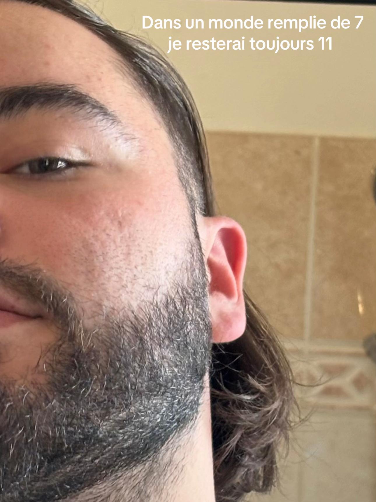@🧟🤠