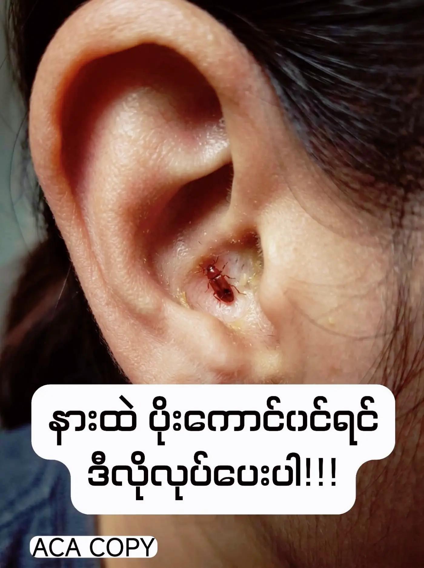 @ခင်